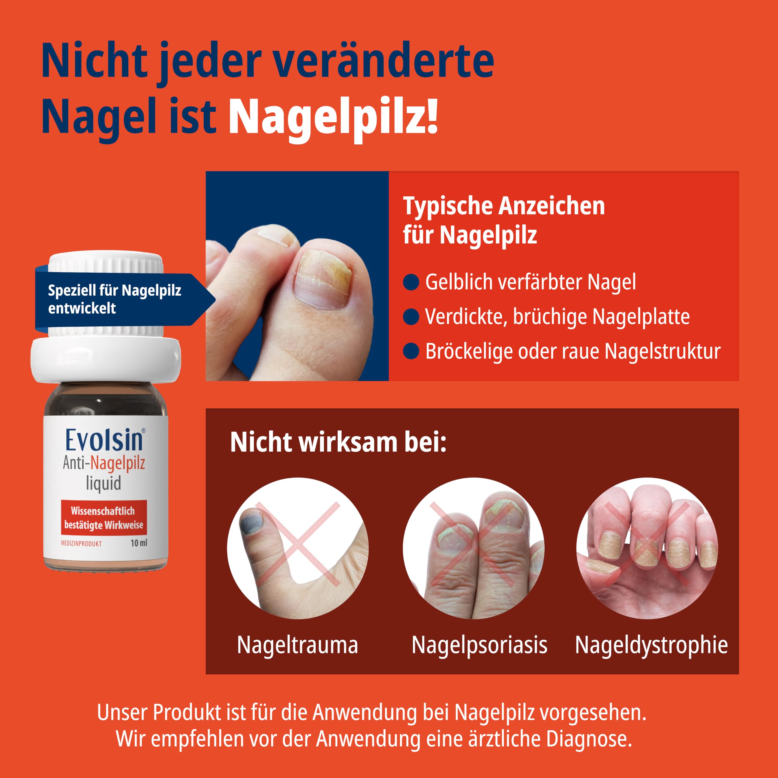 Evolsin® Anti Nagelpilz Liquid Doppelpack - Wissenschaftlich bestätigte Wirkweise I Geeignet für Diabetiker I Medizinprodukt I Nagelpilz Nagellack für Füsse und Hände I Nagelhärter (2x10ml)