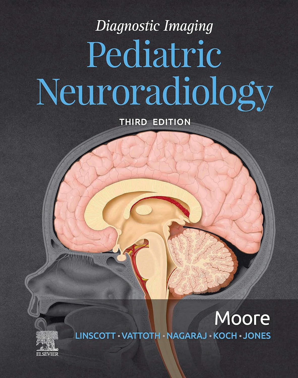 Diagnostic Imaging Pediatric Neuroradiology Diagnostic