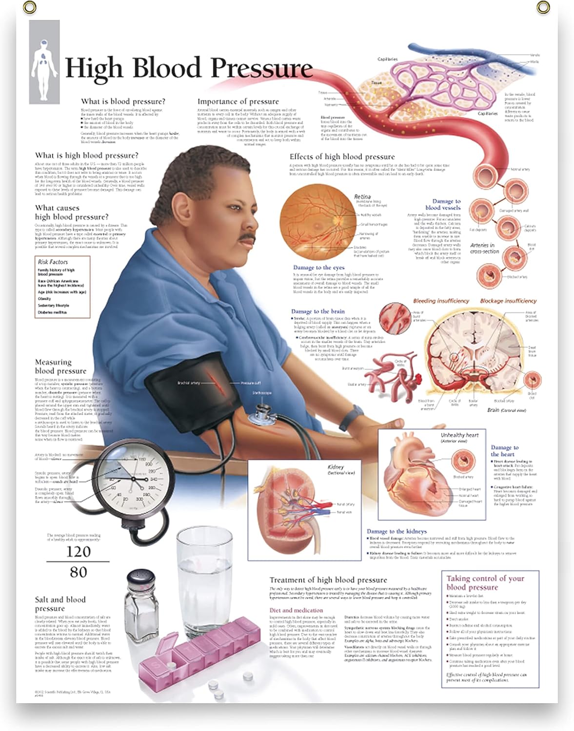 Buy Set of 3 Laminated Medical Posters High Blood Pressure, Effects of