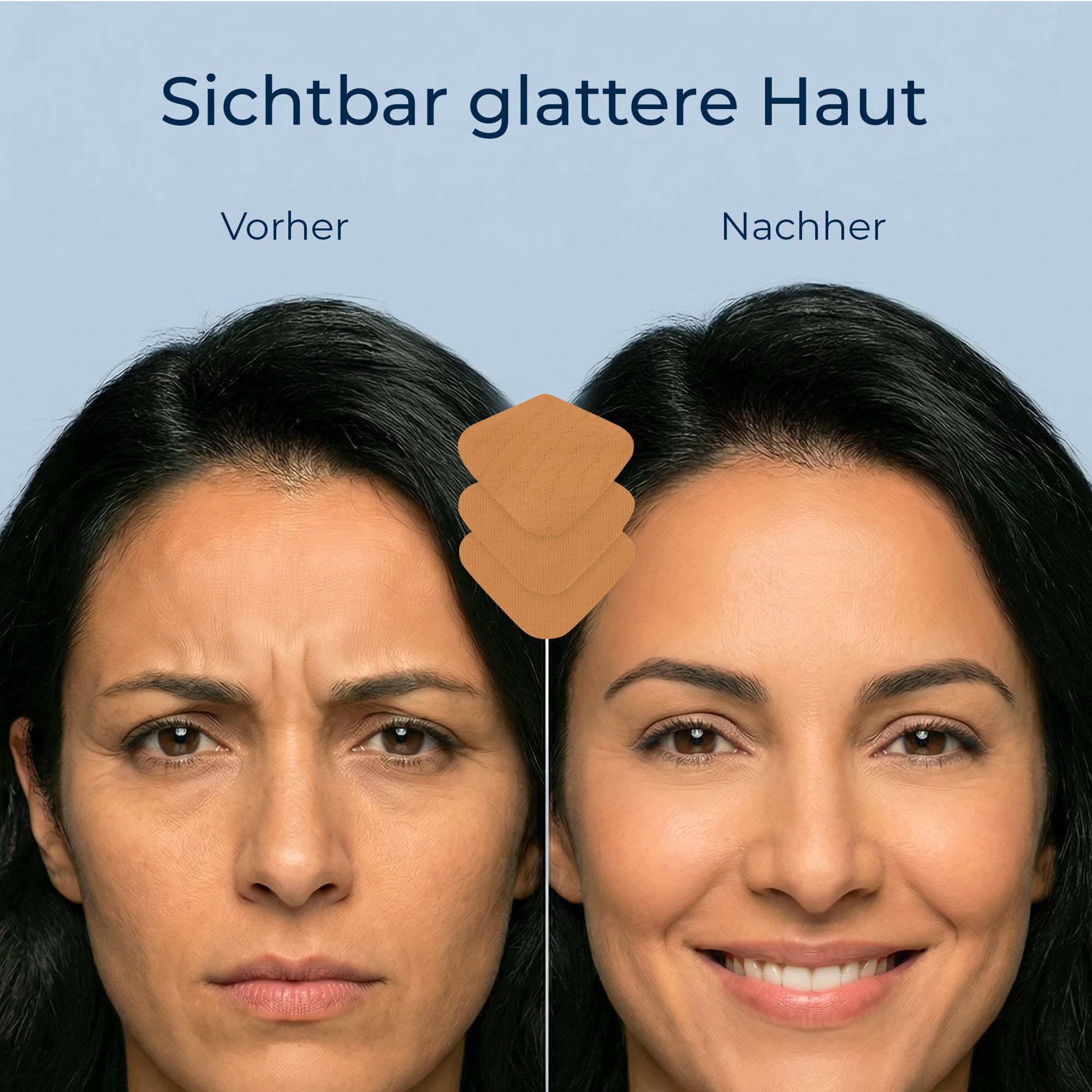 Patches & Pads Zornesfalte Pflaster aus Baumwolle mit Hyaluron 60 Stück - Extra stark haftend - Zornesfalte glätten, Anti Falten Pflaster, Gesichtstape gegen Falten (1er Pack)
