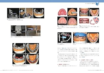 私の臨床ファイル2 パーシャルデンチャーの100症例 オンライン ショップ 安いBooks, Magazines, Manga - 私の臨床