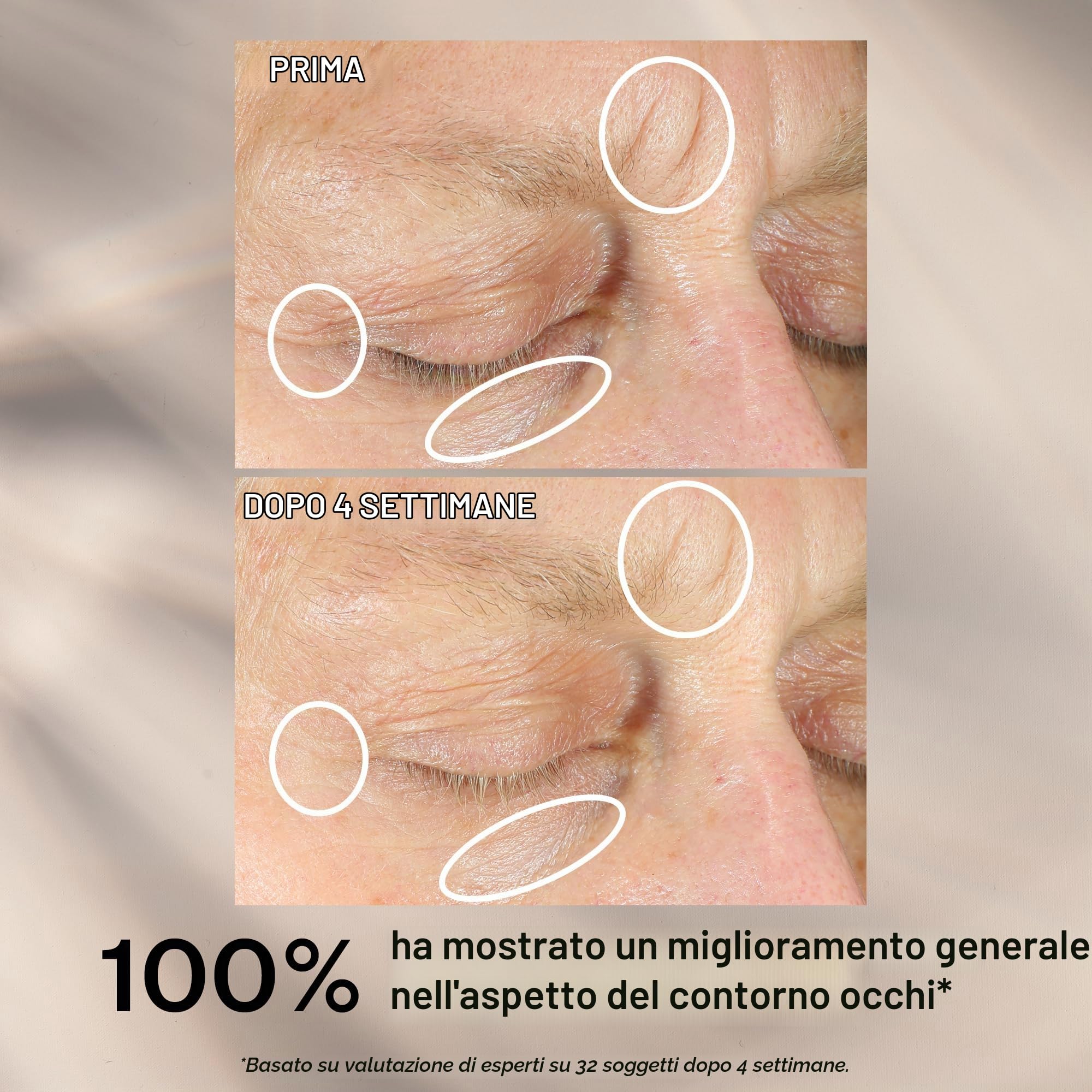 Intensive Eye Concentrate For Wrinkles 30 ml