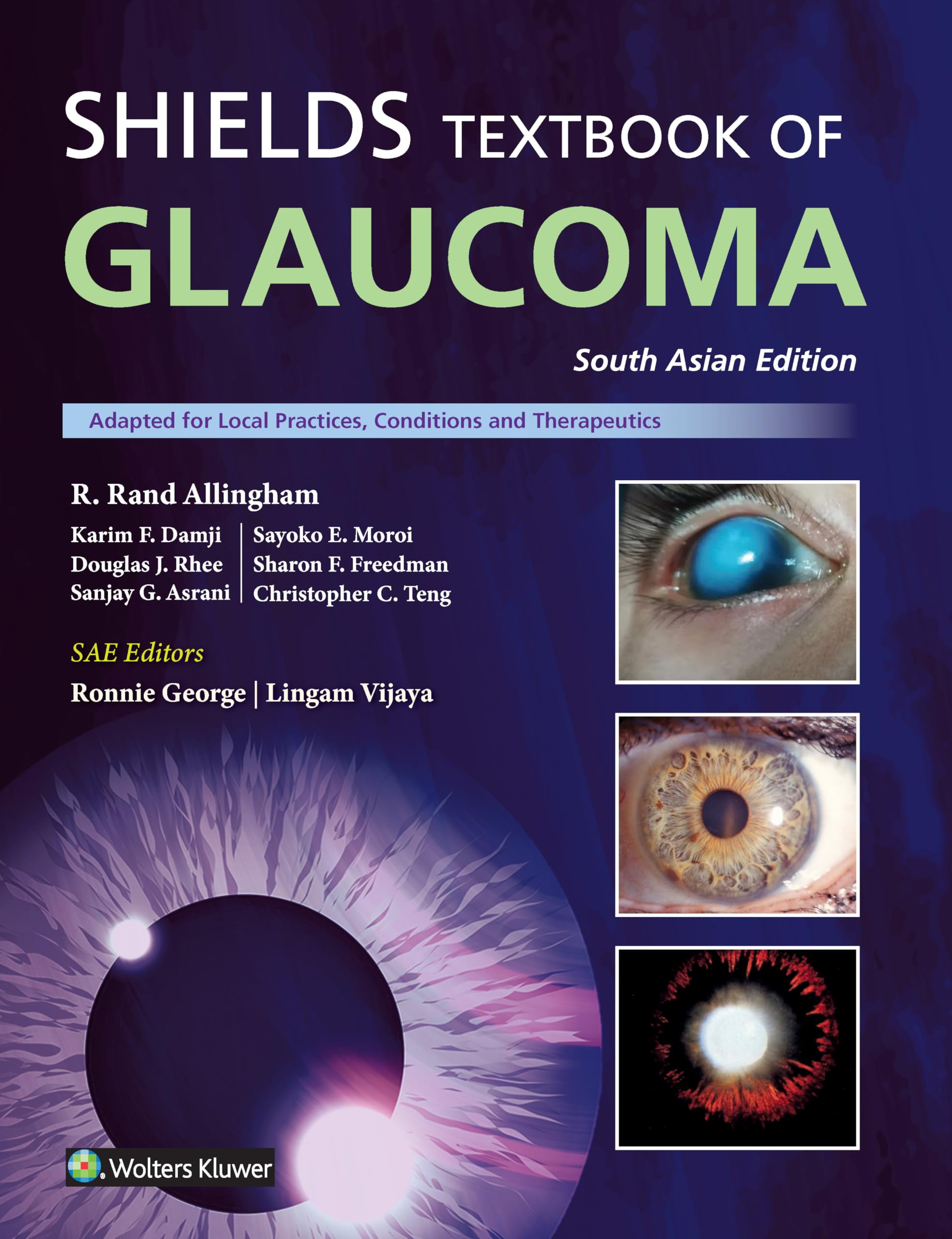 Shield's Textbook of Glaucoma, South Asian ed : R. Rand Allingham