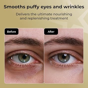 STARSKIN The Gold Mask Eye - Luxury Gold Foil-Topped Cellulose Eye Mask - Serum Concentrated with 83% Rose of Jericho - Smooths Puffy Eyes and Wrinkles