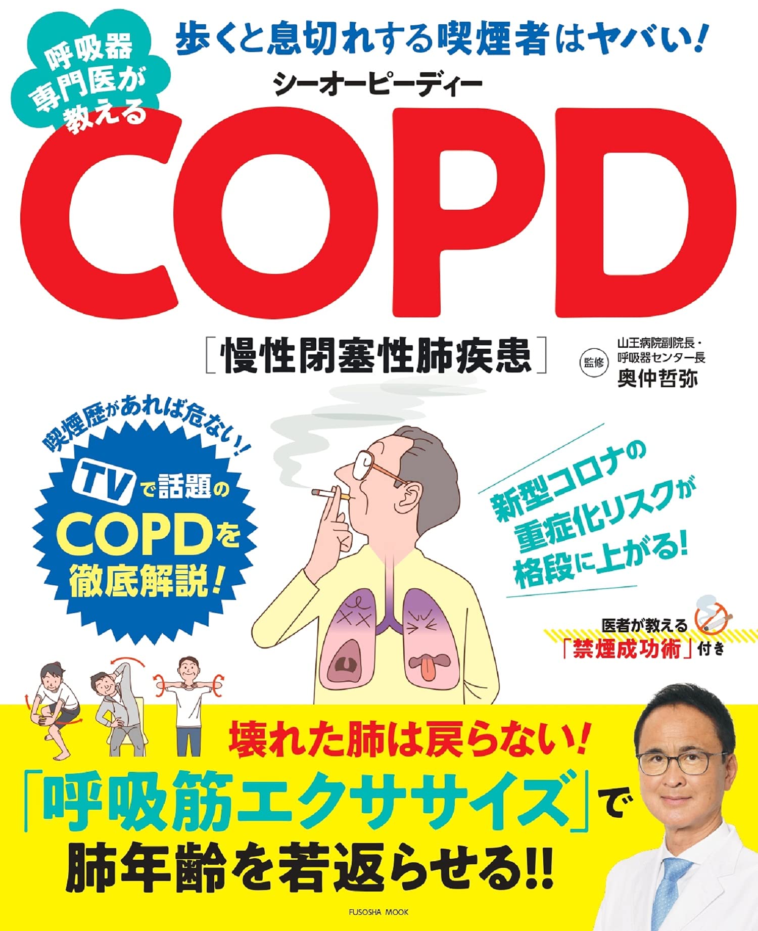 呼吸器専門医が教えるcopd 扶桑社ムック 奥仲 哲弥 本 通販 Amazon