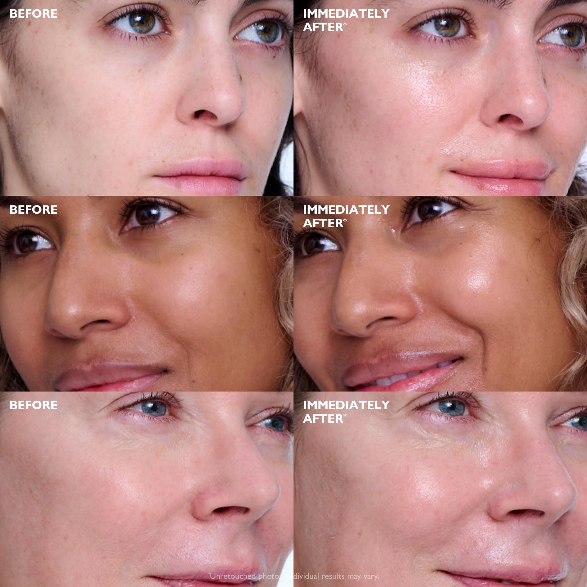 Peter Thomas Roth | Collagen Skinjection™ Plumping & Firming Serum | Skin Barrier Serum, Exosome Serum For Face, Collagen Peptides Serum