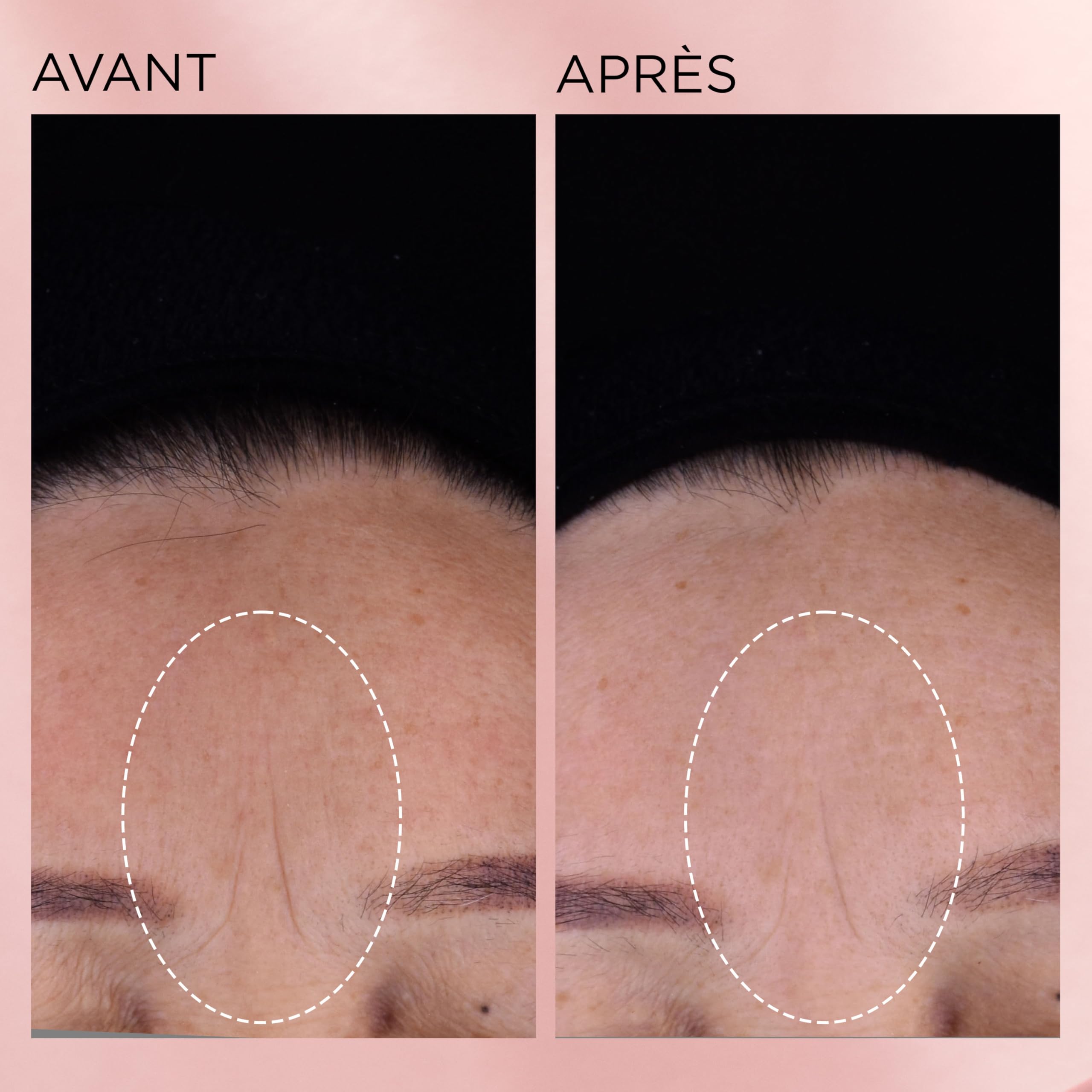 Elizabeth Arden RETINOL + HPR Ceramide Capsules Sérum Régénération Accélérée, Soin anti-âge