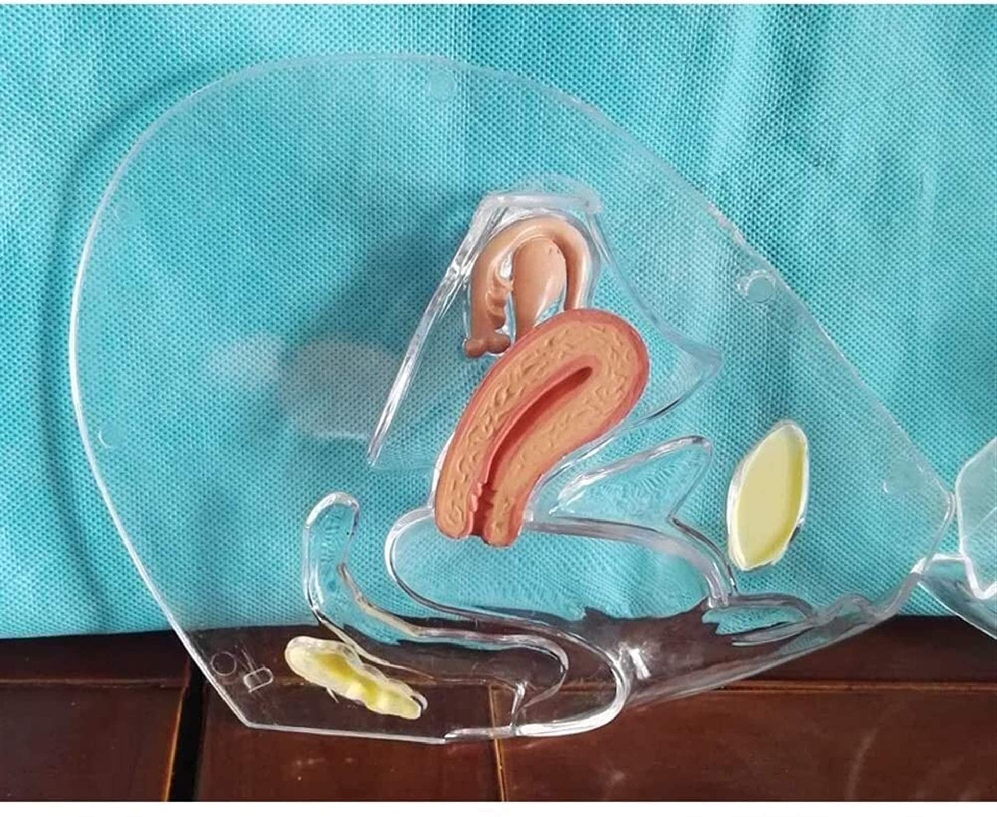 Model Badania Przezroczysty Model Macicy Wydział Medyczny Materiały Dydaktyczne Patologiczny Układ Rozrodczy Macicy Model Anatomia Człowieka