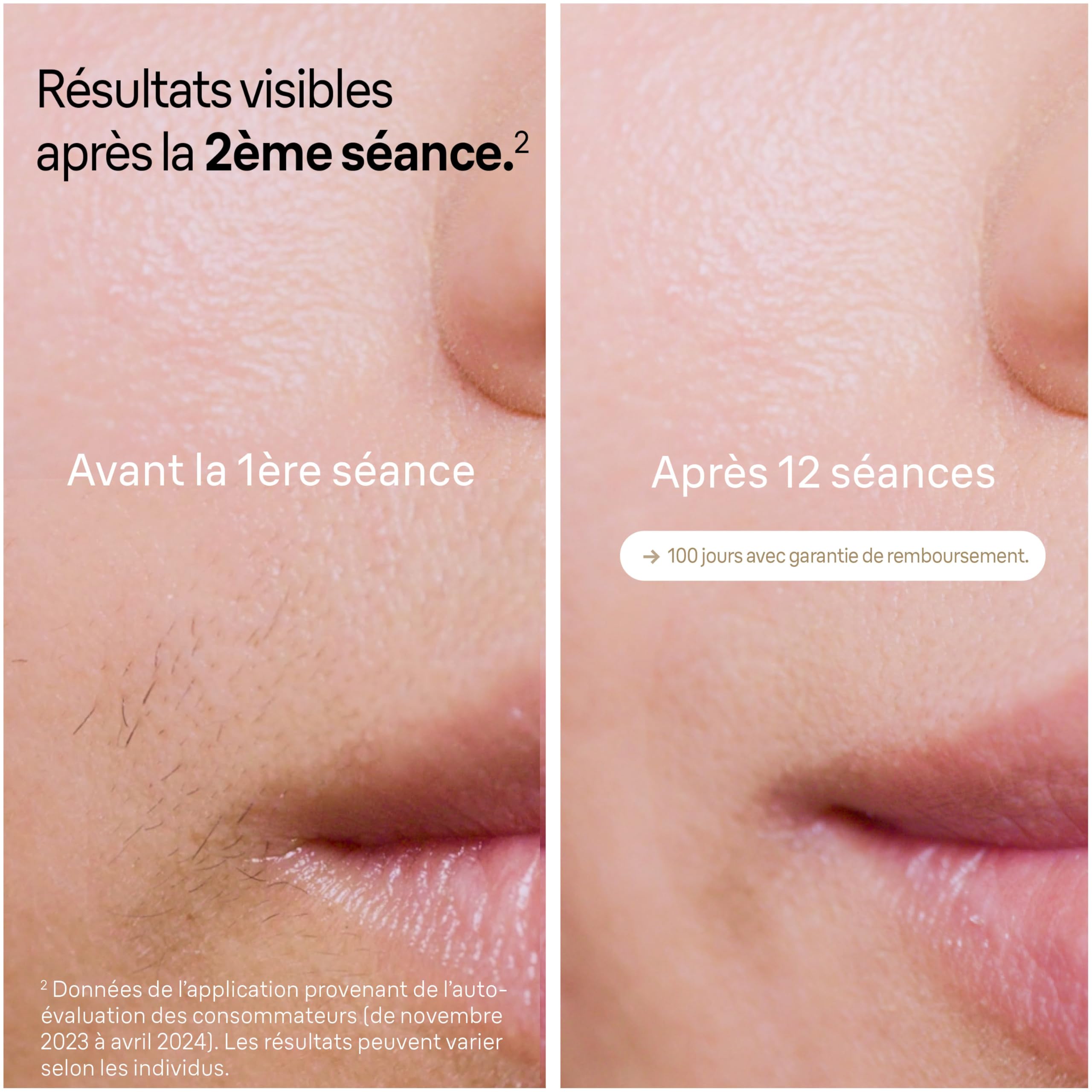 Braun Epilateur Lumiere Pulsee Silk·expert Pro 5 PL5140, Epilation Semi-Définitive, Alternative Au Laser, Résultats En 2 Séances, Rasoir Venus, 2 Têtes Pour Epiler Jambes, Visage, Maillot Et Plus