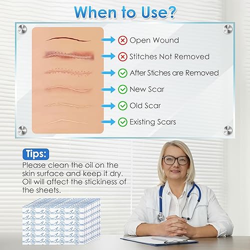 Miniatura 4 de Geiserailie 10 cintas de silicona transparente para cicatrices, tiras de silicona de grado médico, 1.5 x 3 pulgadas, parches de cicatrices para