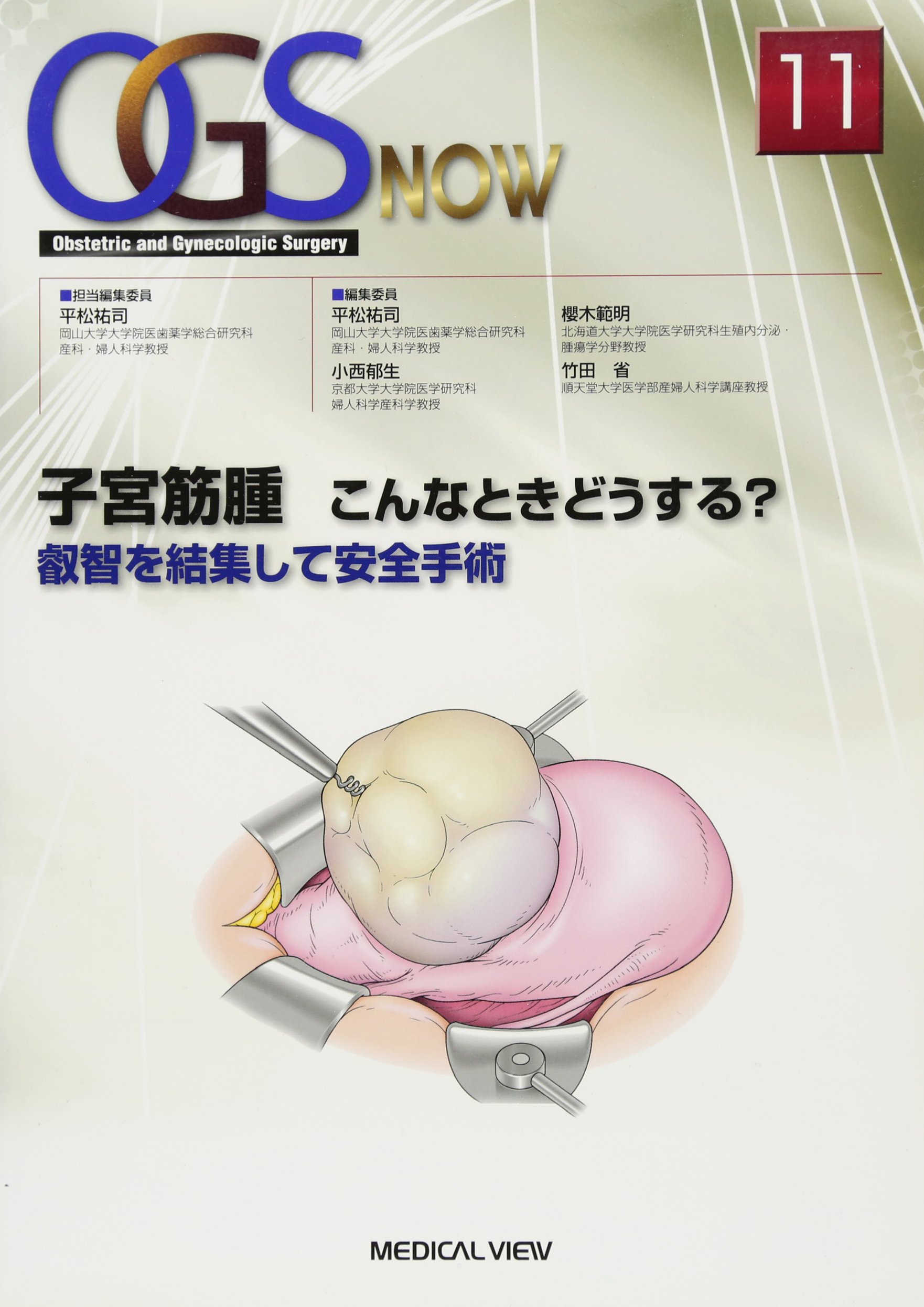 子宮筋腫改善マニュアル 子宮筋腫 こんなときどうする? (OGS NOW No. 11) | 平松 祐司 |本