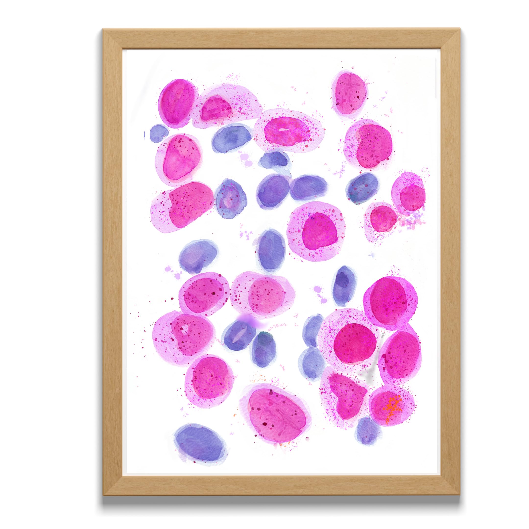 Acute Myeloid Leukemia Hematology Oncology Art Print, Fine Art Print, Gift for Hematologist, Oncologist, Pathologist Assistant Doctor Nurse (5x7 in)