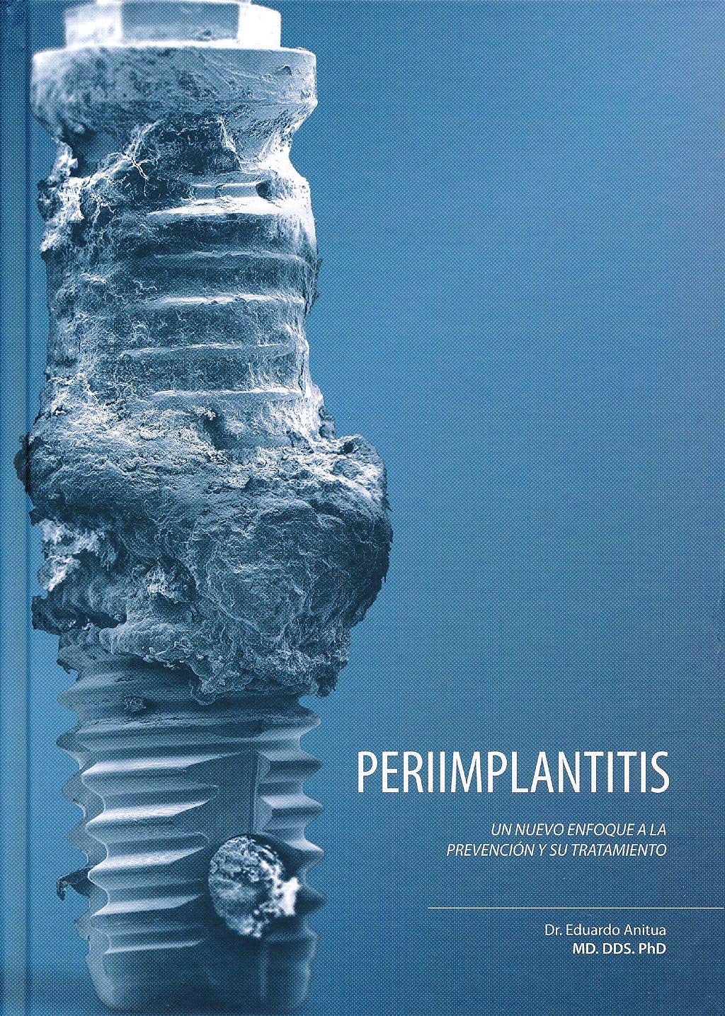 Periimplantitis. Un nuevo enfoque a la prevención y su tratamiento