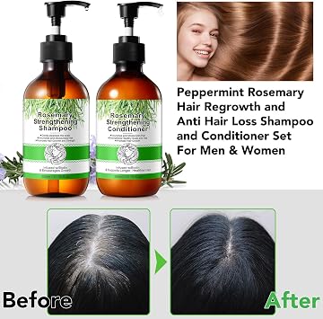 Rosemary Shampoo and Conditioner Set, Hair Growth Rosemary Shampoo and Conditioner Against Hair Loss, Nourishes Scalp, Biotin rosemary oil Hair Thickening Products for Women and Men, Sulfate Free