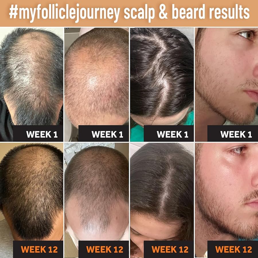 Biotin Hair Growth Conditioner for Men and Women - Treatment for Thinning Hair and Hair Loss with Natural and Vegan DHT Blockers - Caffeine, Saw Palmetto, Niacin, Zinc - Cruelty and Paraben Free - image 4