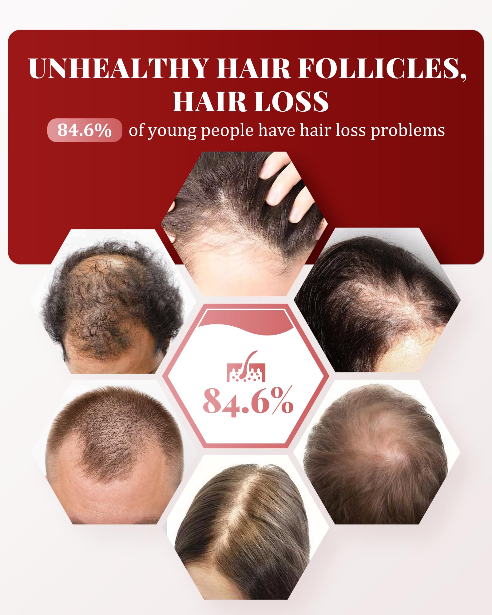 KTS Rotlicht Haarwachstum Kamm, 660nm&650nm Rotlicht Duales Lichtspektrum für die Kopfhautpflege,Haarausfall-Behandlung für Frauen/Männer, stellt Haardicke, Volumen,haarwachstum beschleunigen