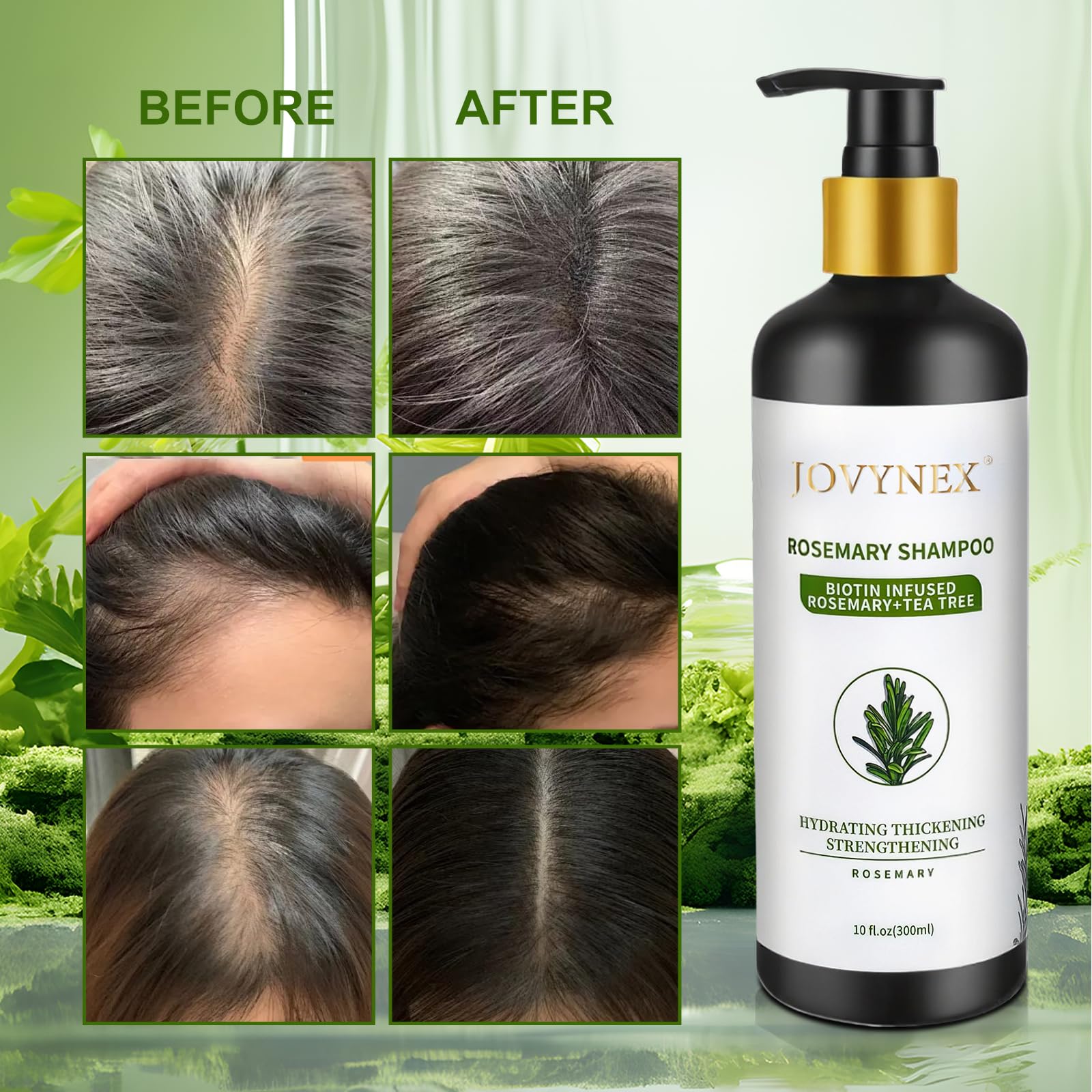 Champú para el crecimiento del cabello con romero, 10 onzas líquidas 5