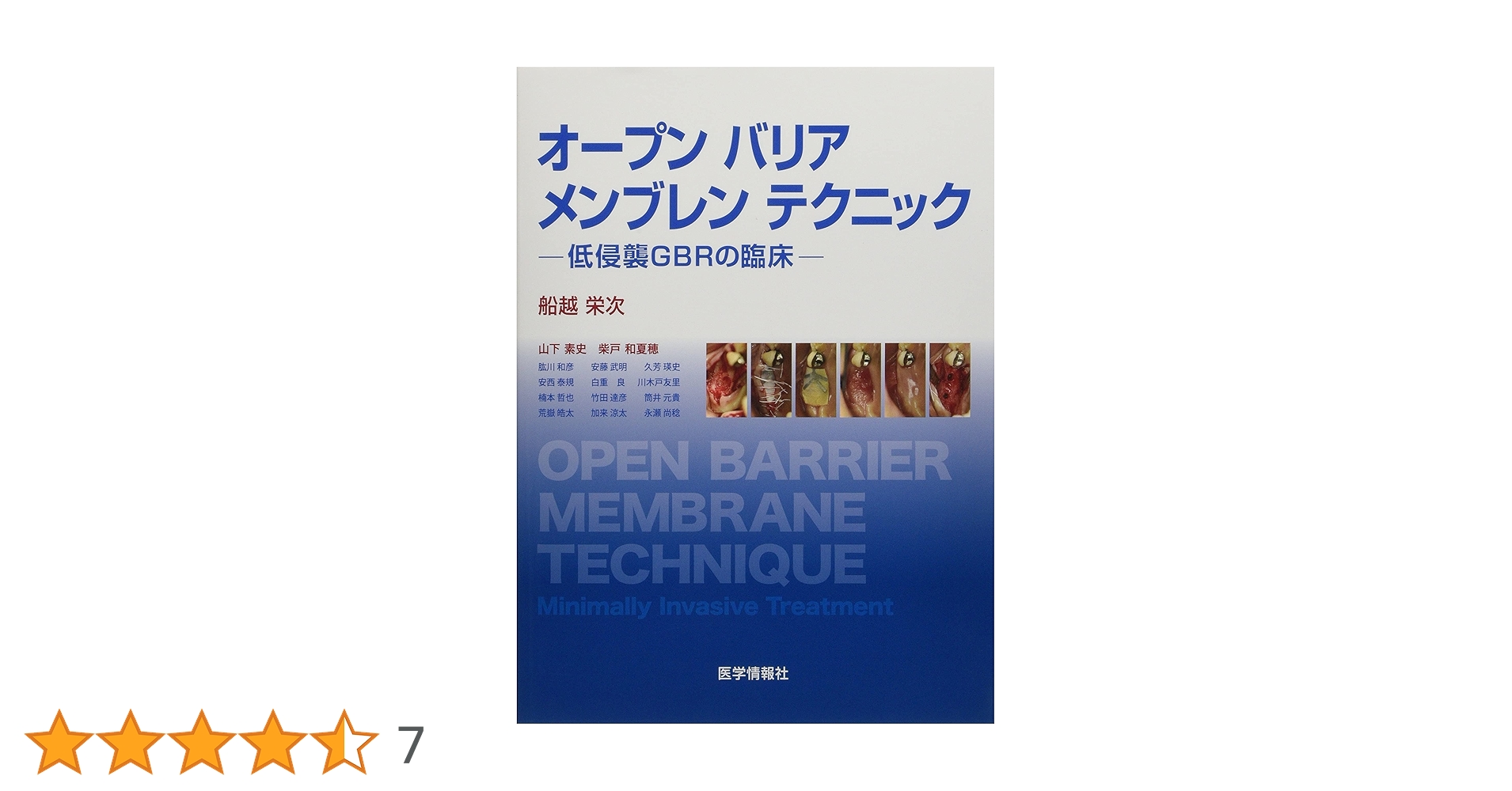 【裁断済み】オープンバリアメンブレンテクニック Amazon.co.jp: オープンバリアメンブレンテクニック: 低侵襲GBR