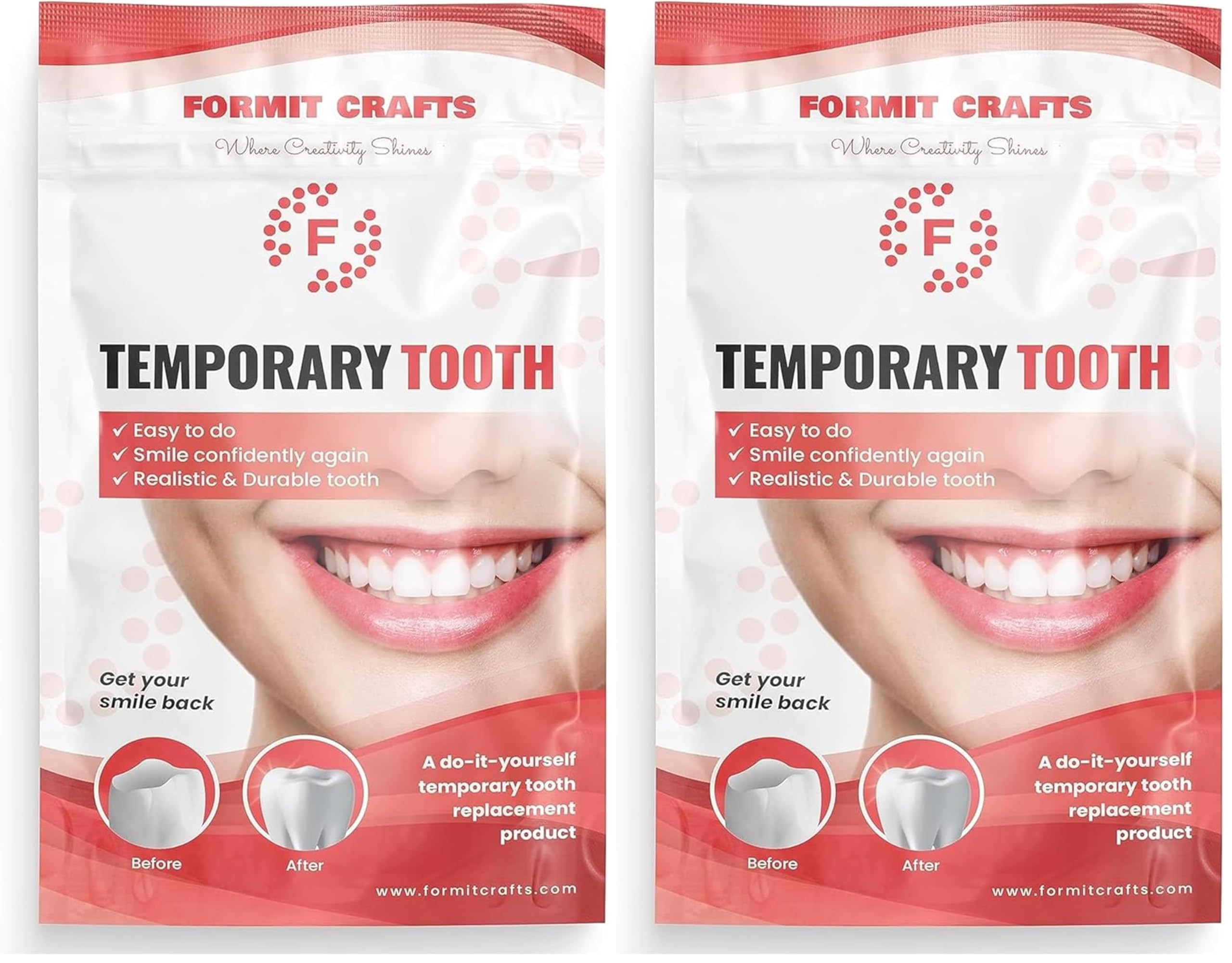 Thermoplastic Beads for DIY Tooth Filling Moldable Thermal Beads for Chipped, Cracked Teeth Realistic and Durable (40 Grams) (Pack of 2)