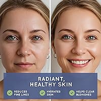 Vista 3 de Essential Source Bonita V - Uñas veganas para el cabello y vitaminas para la piel para mujeres, 20 ingredientes activos, incluyendo biotina