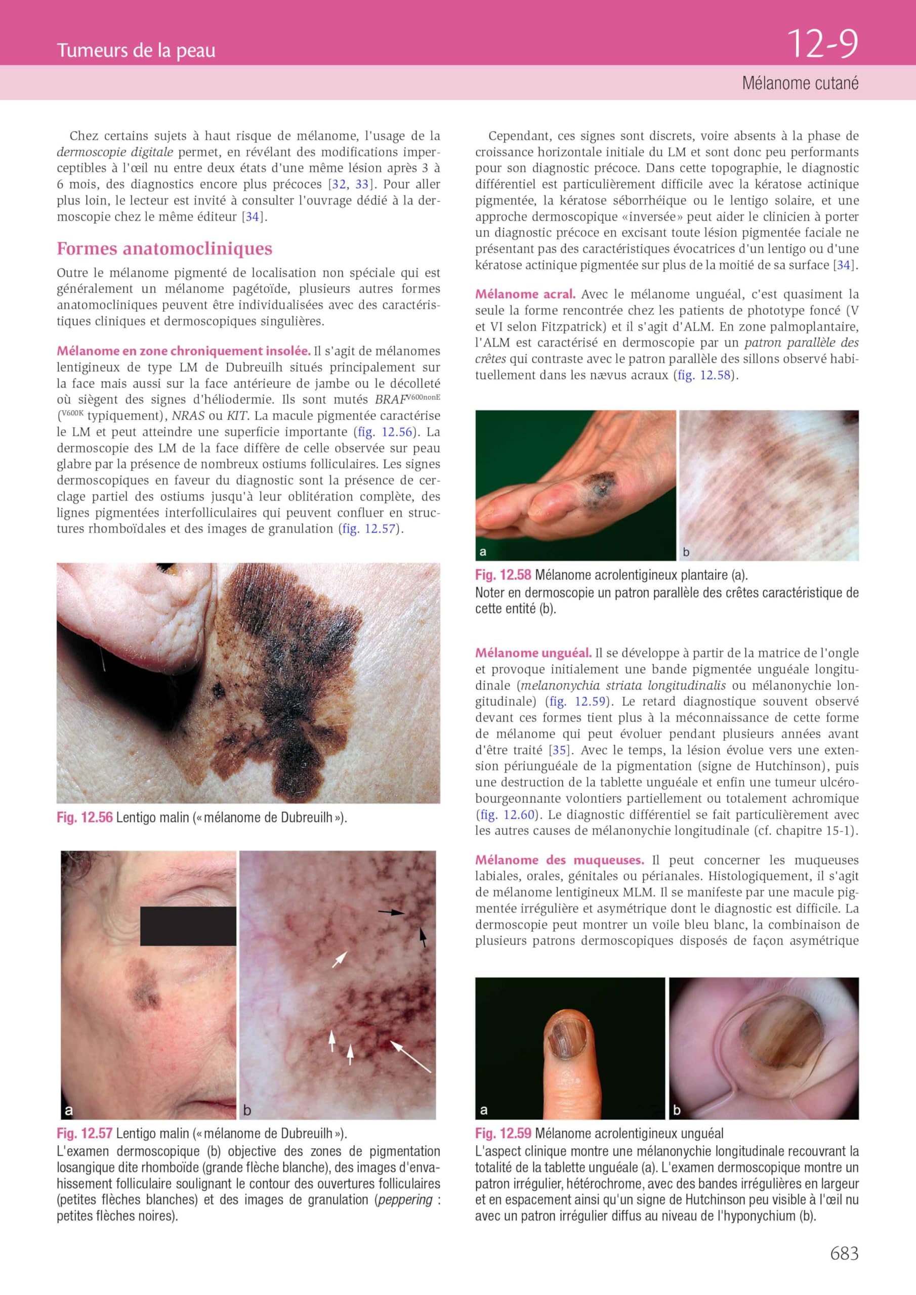 Dermatologie et infections sexuellement transmissibles: Avec ebook