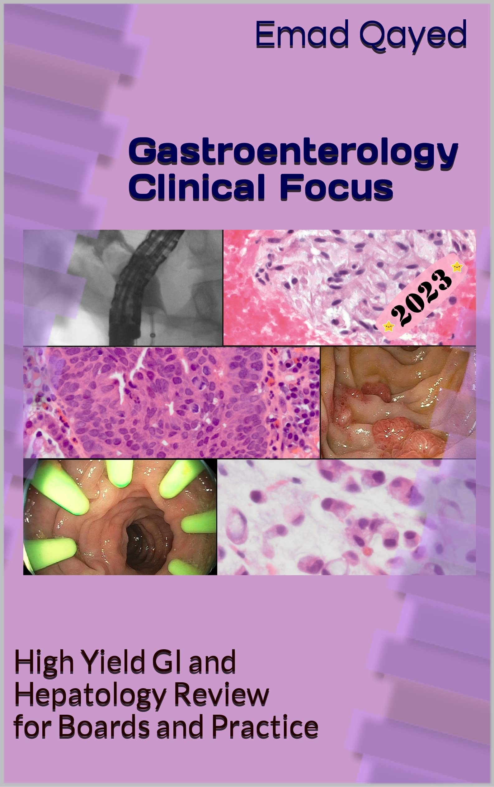 Gastroenterology Clinical Focus: High Yield GI and Hepatology Review- for Boards and Practice
