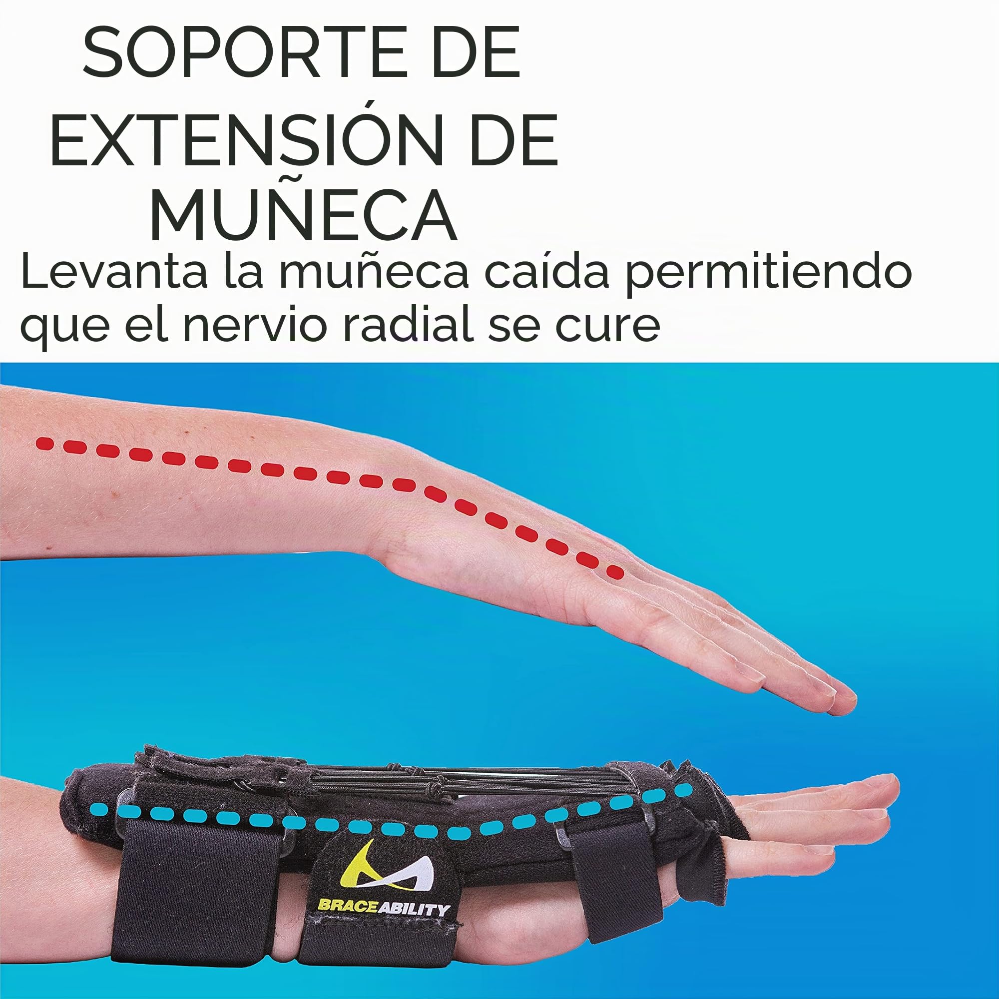 BraceAbility Férula de parálisis del nervio radial, férula dinámica de caída de muñeca para extensión de muñeca de dedo flácido, sábado por la noche, luna de miel, parálisis de muleta, soporte de