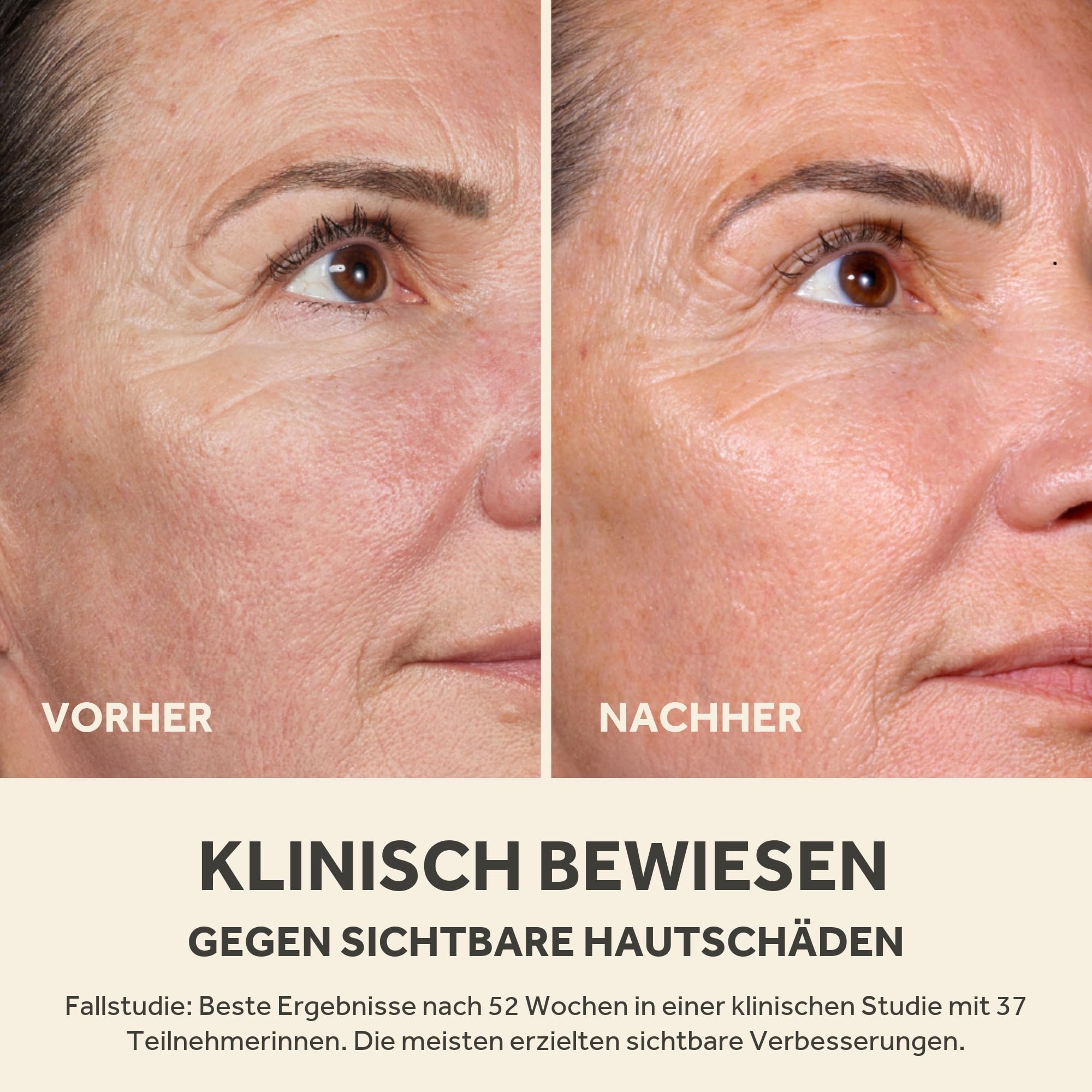 No7 Future Renew Face Serum - Gesichtsserum mit Peptidtechnologie, 50 ml | Kehrt sichtbare Anzeichen von Hautschäden um, Feuchtigkeitsserum Gesicht, Feuchtigkeitspflege
