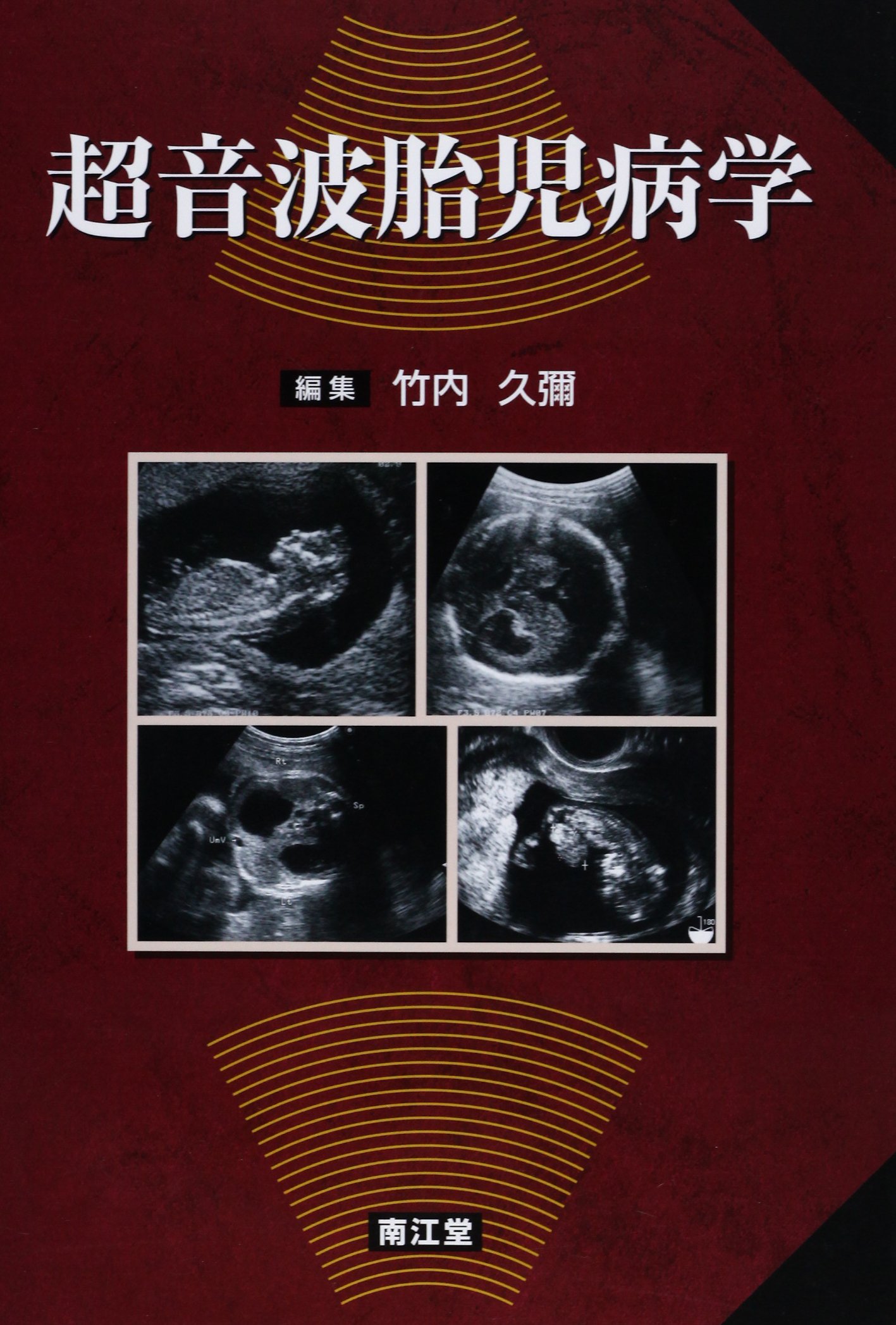 超音波胎児病学 | 竹内 久彌 |本 | 通販 | Amazon