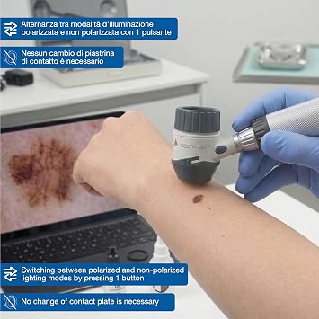 Heine Delta 20 T.4 USB Dermatoscope Kit