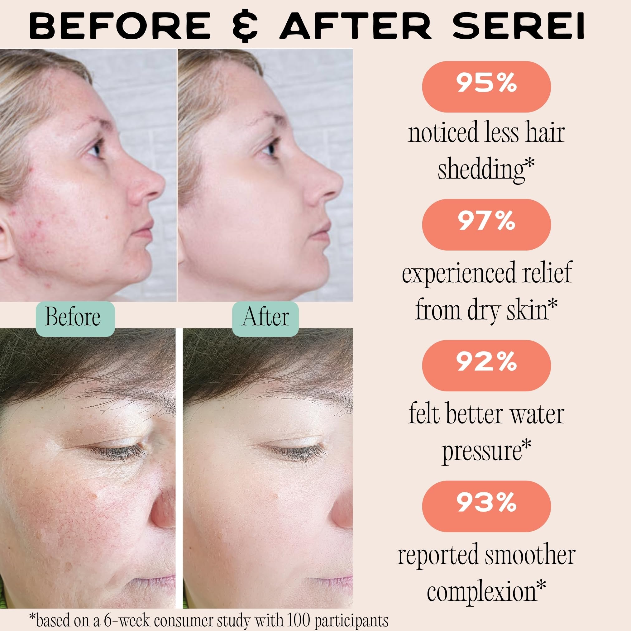 Serei Cabezal de ducha filtrado, reduce la piel seca, la caspa, el eccema y mejora la salud de tu piel, cabello y uñas, el mejor filtro de cabezal de ducha para cloro y agua dura (2.0 negro azabache)