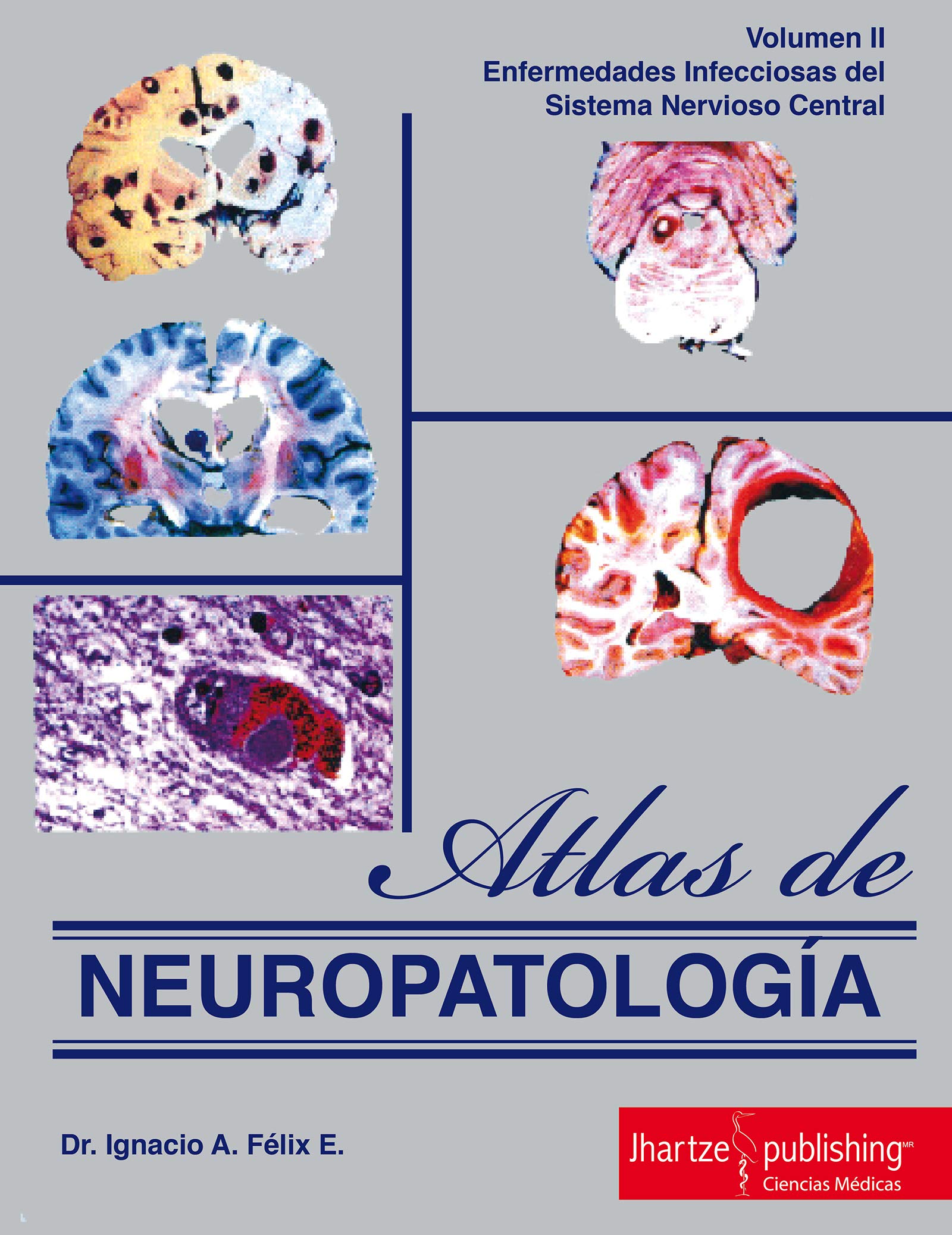 ATLAS DE NEUROPATOLOGÍA (NEUROPATOLOGIA) (Spanish Edition)