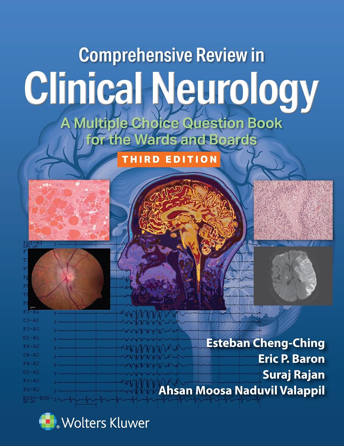Comprehensive Review in Clinical Neurology: A Multiple Choice Question Book for the Wards and Boards