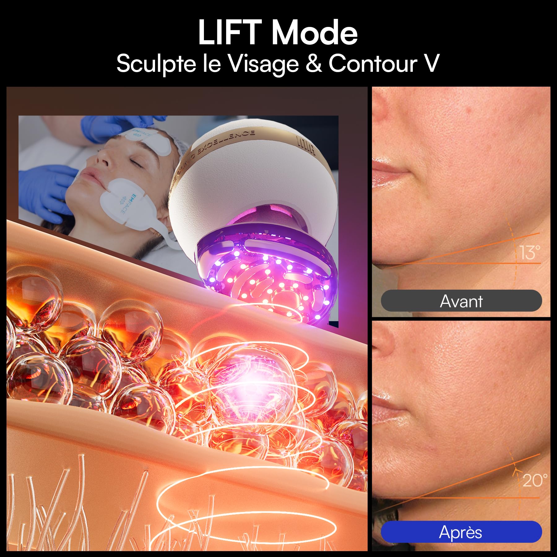 INIA SPHERA Appareil Facial Microcourant 8-en-1 Amélioré pour Visage et Cou – Lumière Rouge, Chauffant & Refroidissant, 5 Modes Personnalisés, Soin de la Peau et Éclat à Domicile