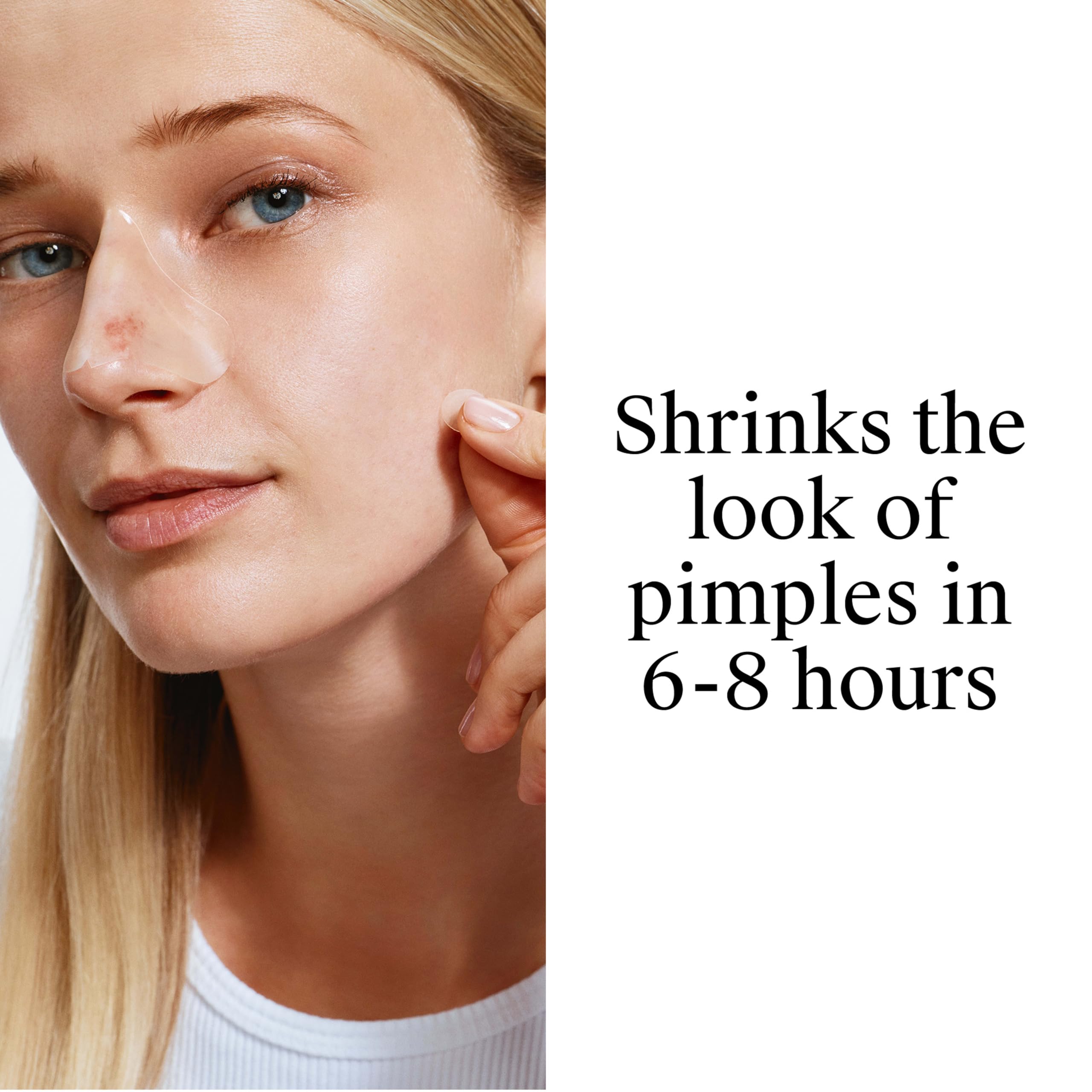 Neutrogena Acne Patches - Shrink Pimples Overnight -2 Neutrogena Acne Patches - Shrink Pimples Overnight -2