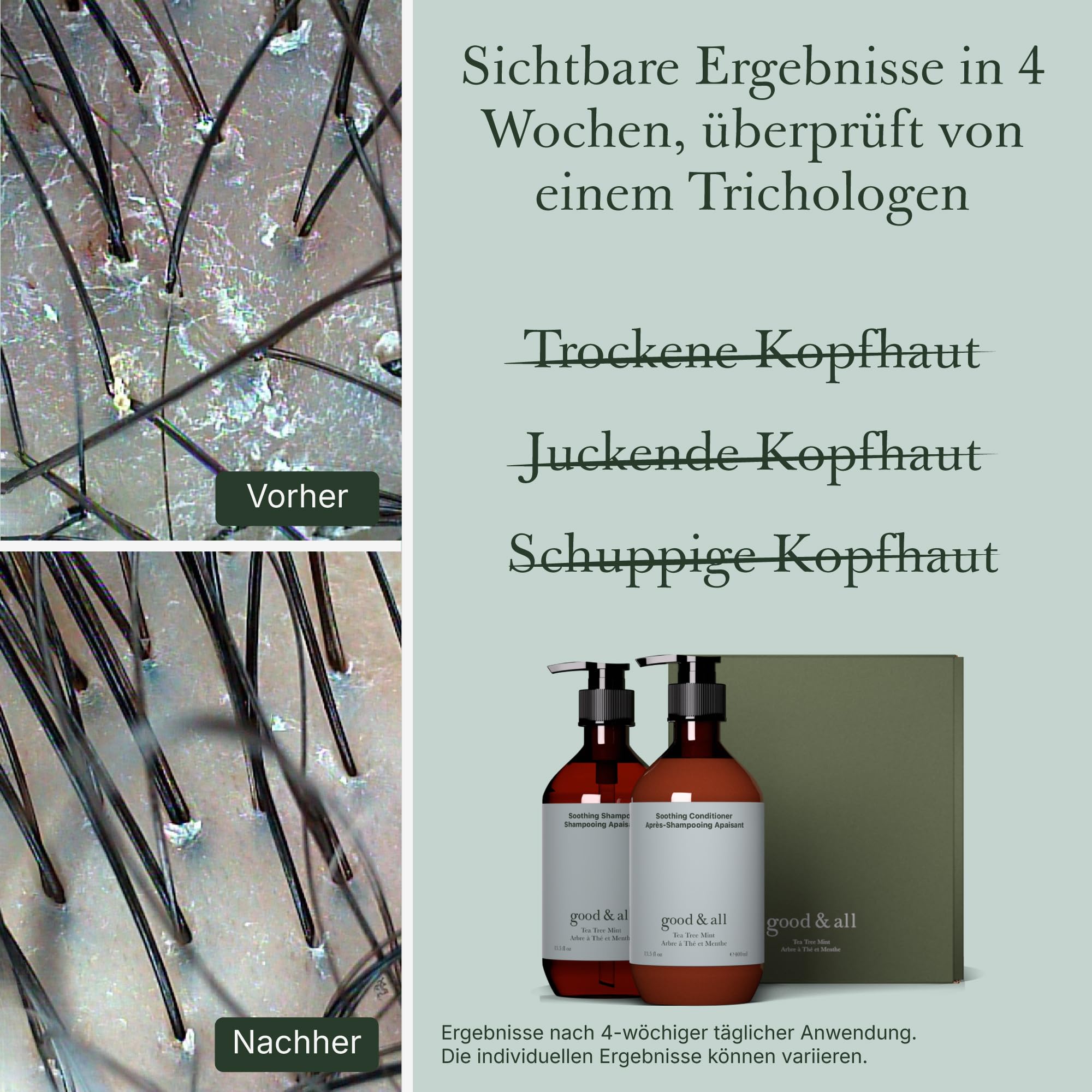Good&All Shampoo & Conditioner Set für Trockene, Juckende Kopfhaut mit Teebaumöl, Pfefferminze - Sulfatfrei, Silikonfrei, Parabenfrei - 400ml