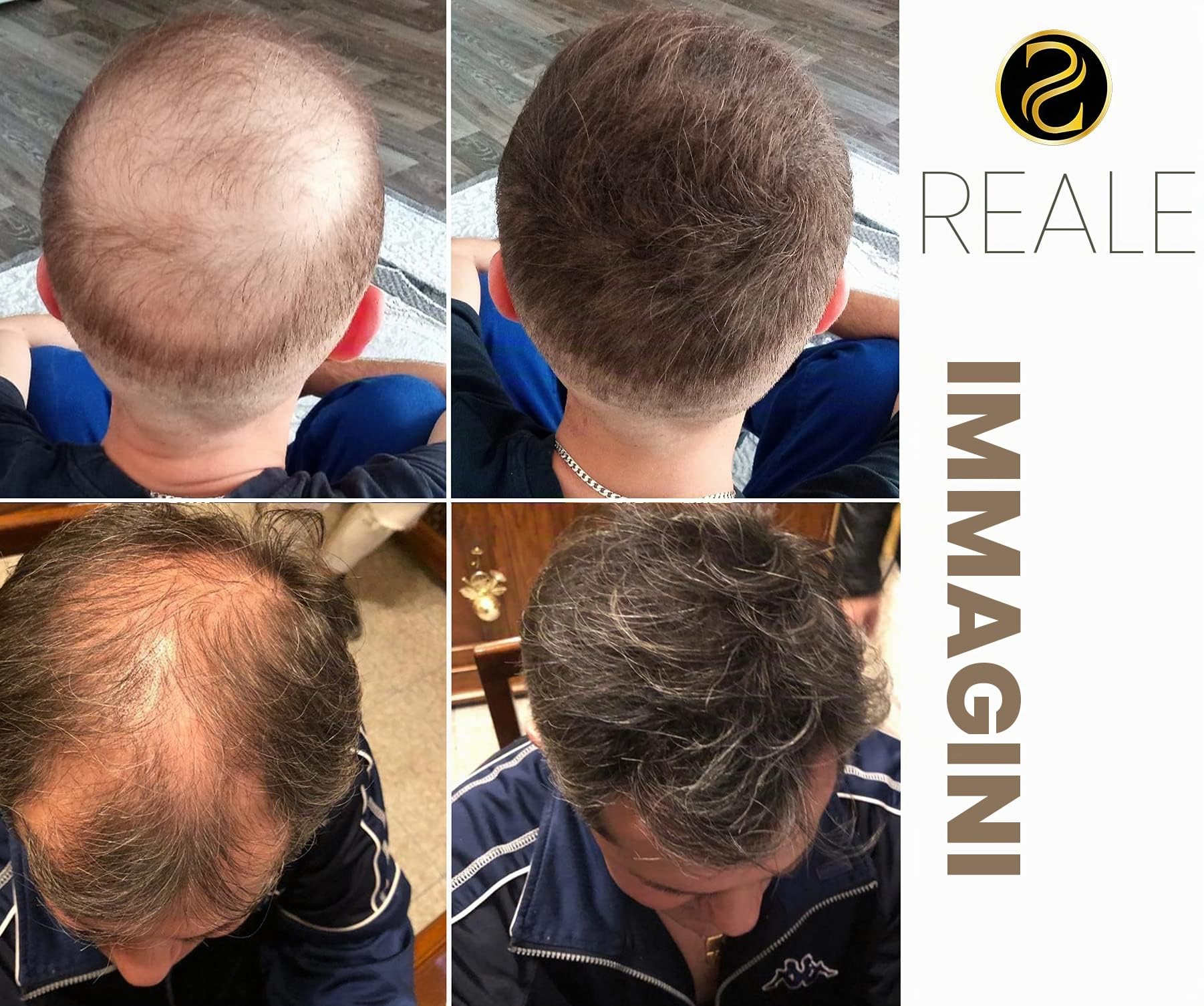 Fibre per Capelli, Hair Fibers, Polvere per Capelli fatto di cotone, Soluzione Professionale per la Perdita di Capelli per Donne e Uomini Prodotti Migliori 25g (marrone medio)