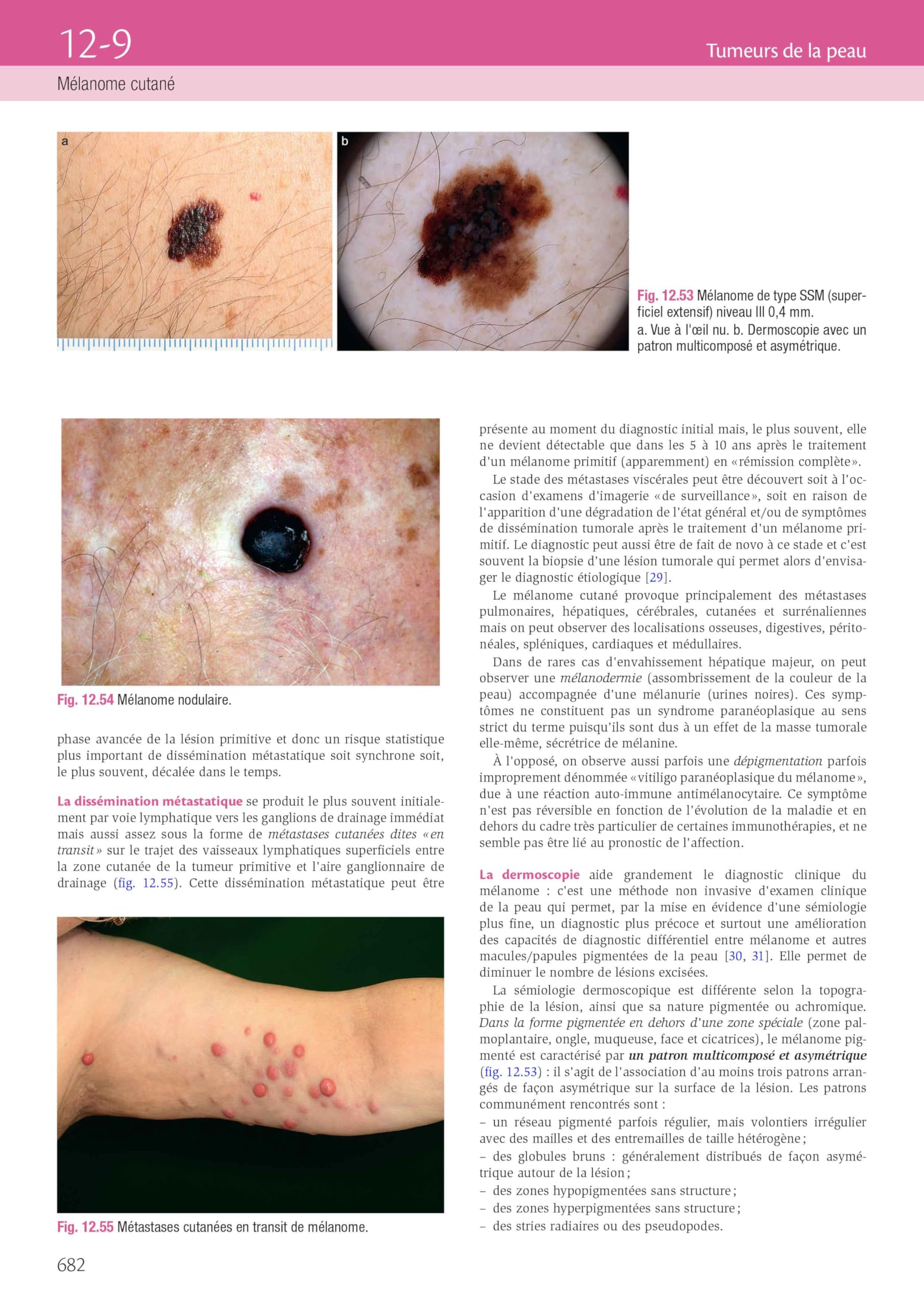 Dermatologie et infections sexuellement transmissibles: Avec ebook