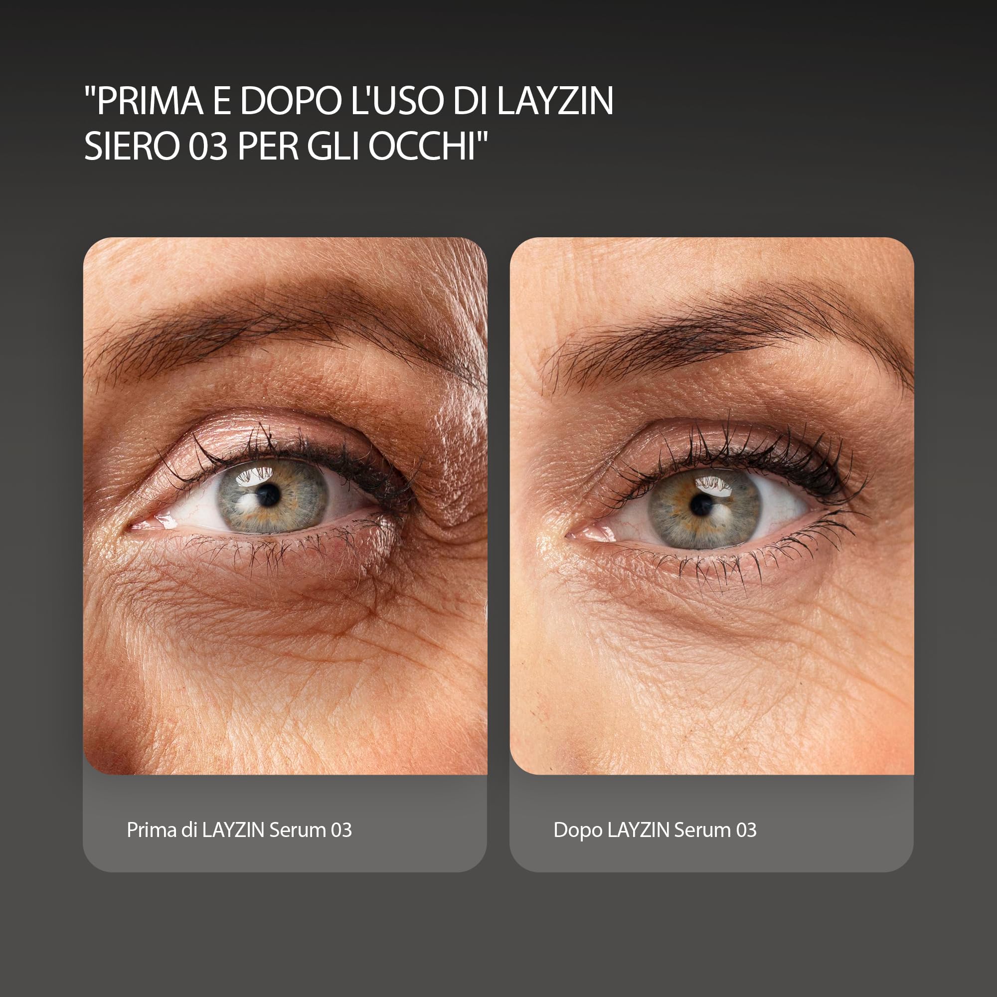 Siero Occhi SERUM 03 contro Occhiaie & Borse – Cura Occhi con Complesso Brevettato REGU-AGE® – Riduce Rughe, Iperpigmentazione & Ritenzione Idrica – Caffeina, Antiossidanti & Complesso Vegetale