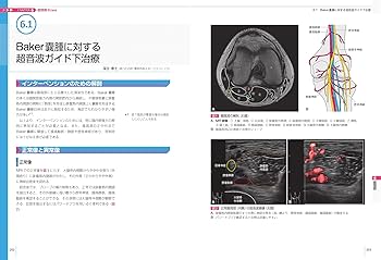 運動器超音波ガイド下治療・手術 | 熊井 司, 杉本勝正, 佐藤公治