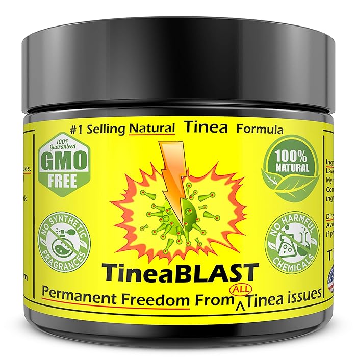 Buy Tinea Versicolor Treatment Cream FAST Relief than soap, Body wash