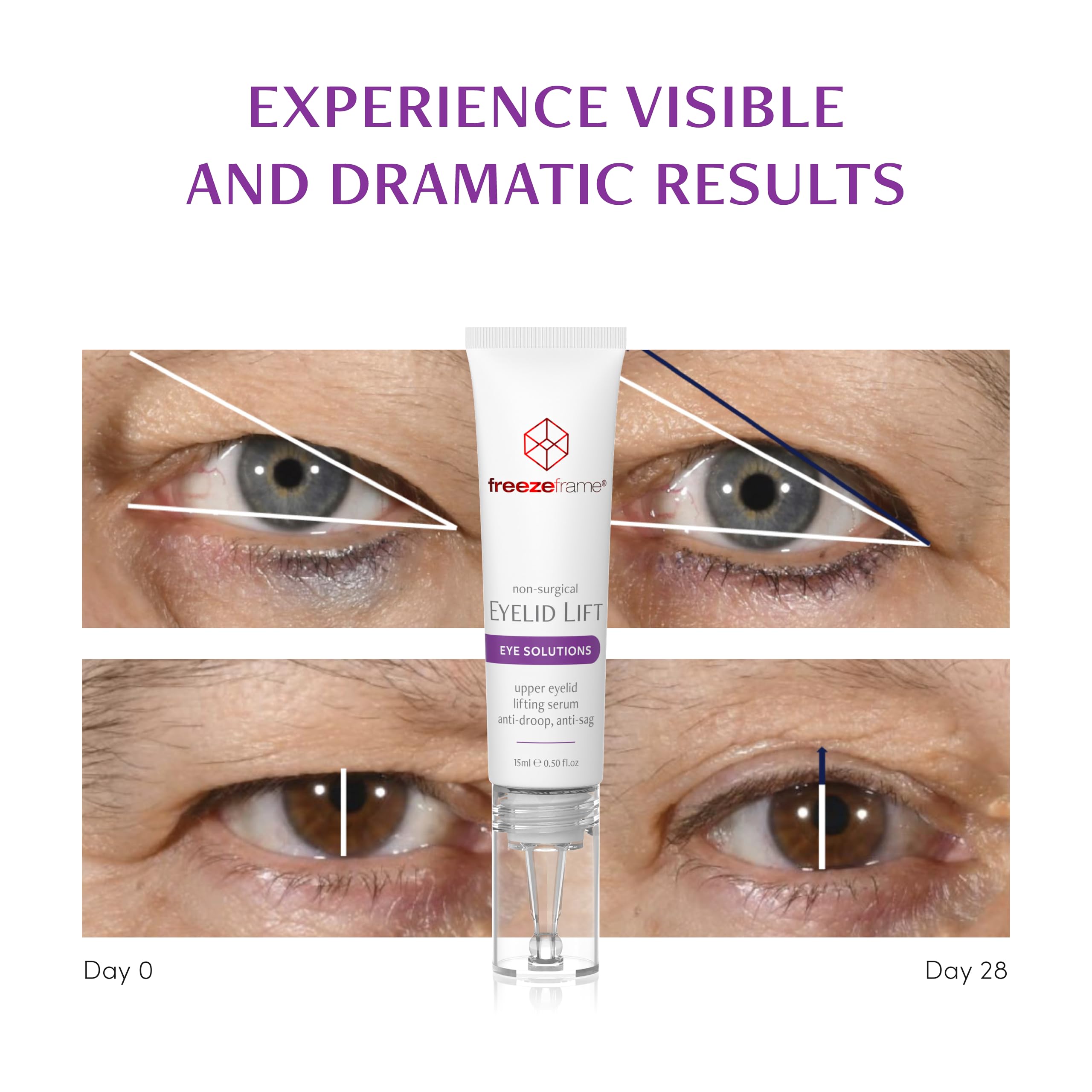 freezeframe, Eyelid Lift, Clinical Lifting Eye Gel and Eye Serum, Lifts and Opens Eyes, Anti-droop - Image 4