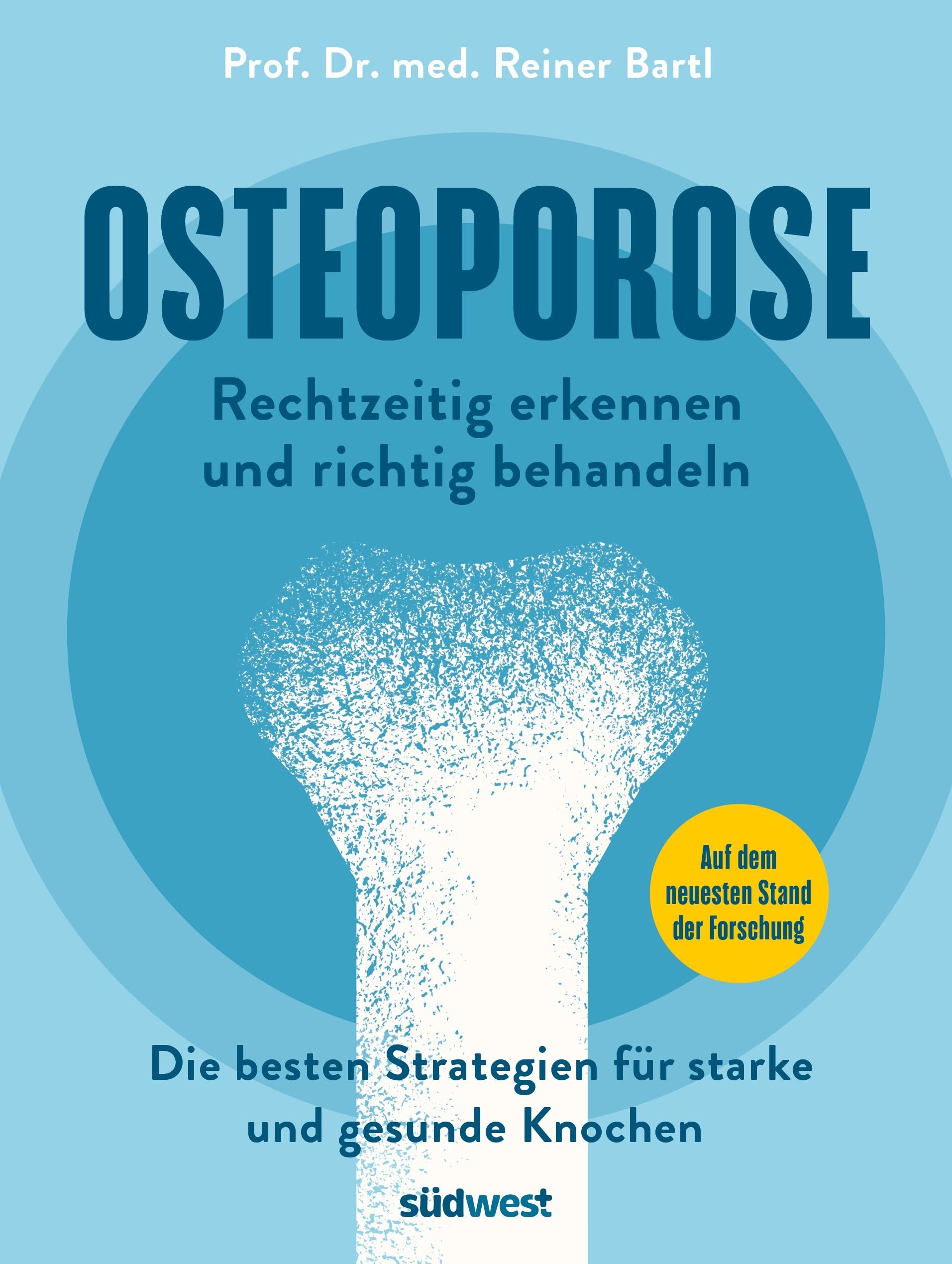 Osteoporose rechtzeitig erkennen und behandeln: Die besten Strategien für starke und gesunde Knochen