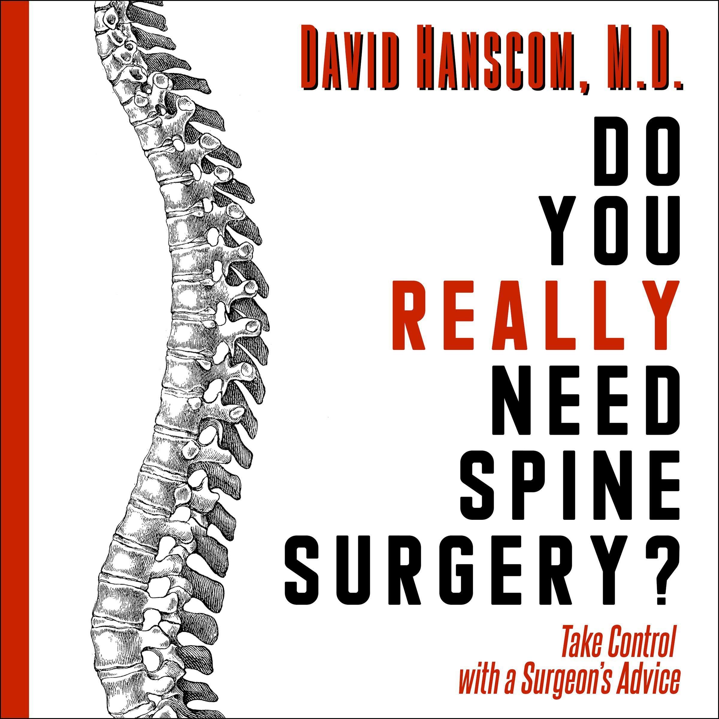 Do You Really Need Spine Surgery?