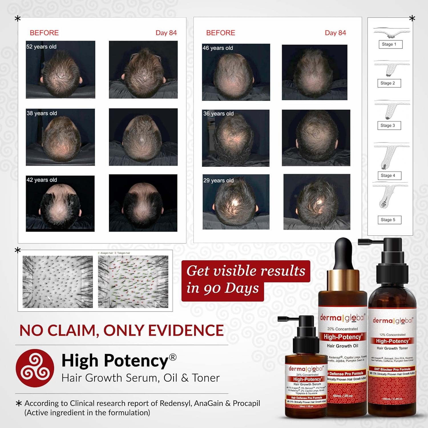 High Potency® Hair Growth Serum – Hair Defence Pro Formula | 24% Clinically Proven Actives with 5% Anagain, 5% Baicapil, 4% Procapil, Redensyl, 2% Capilia Longa, Niacinamide & Copper Peptide 30 mL - Image 4