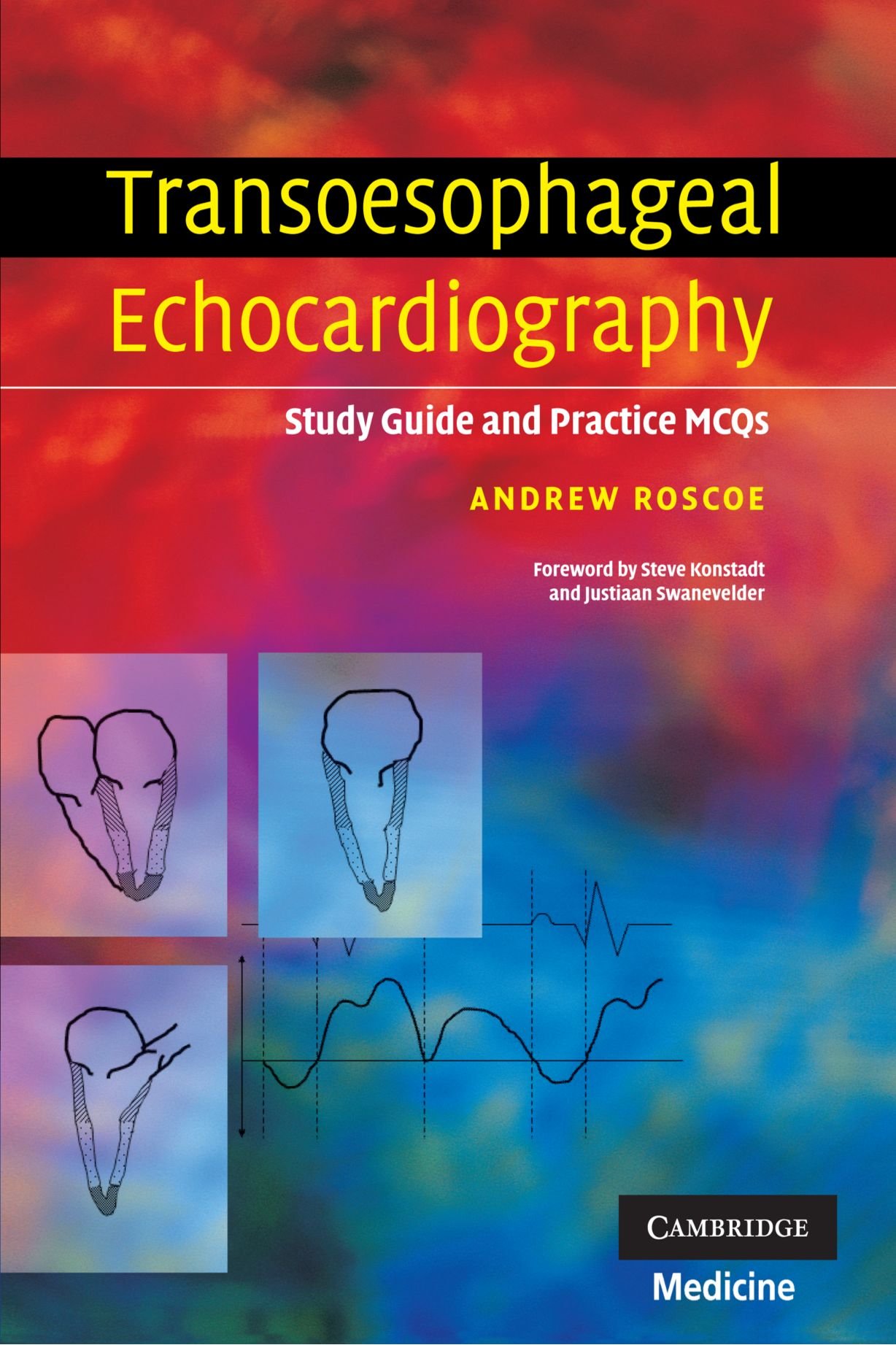 Transoesophageal Echocardiography by Andrew Roscoe - 9780521689601
