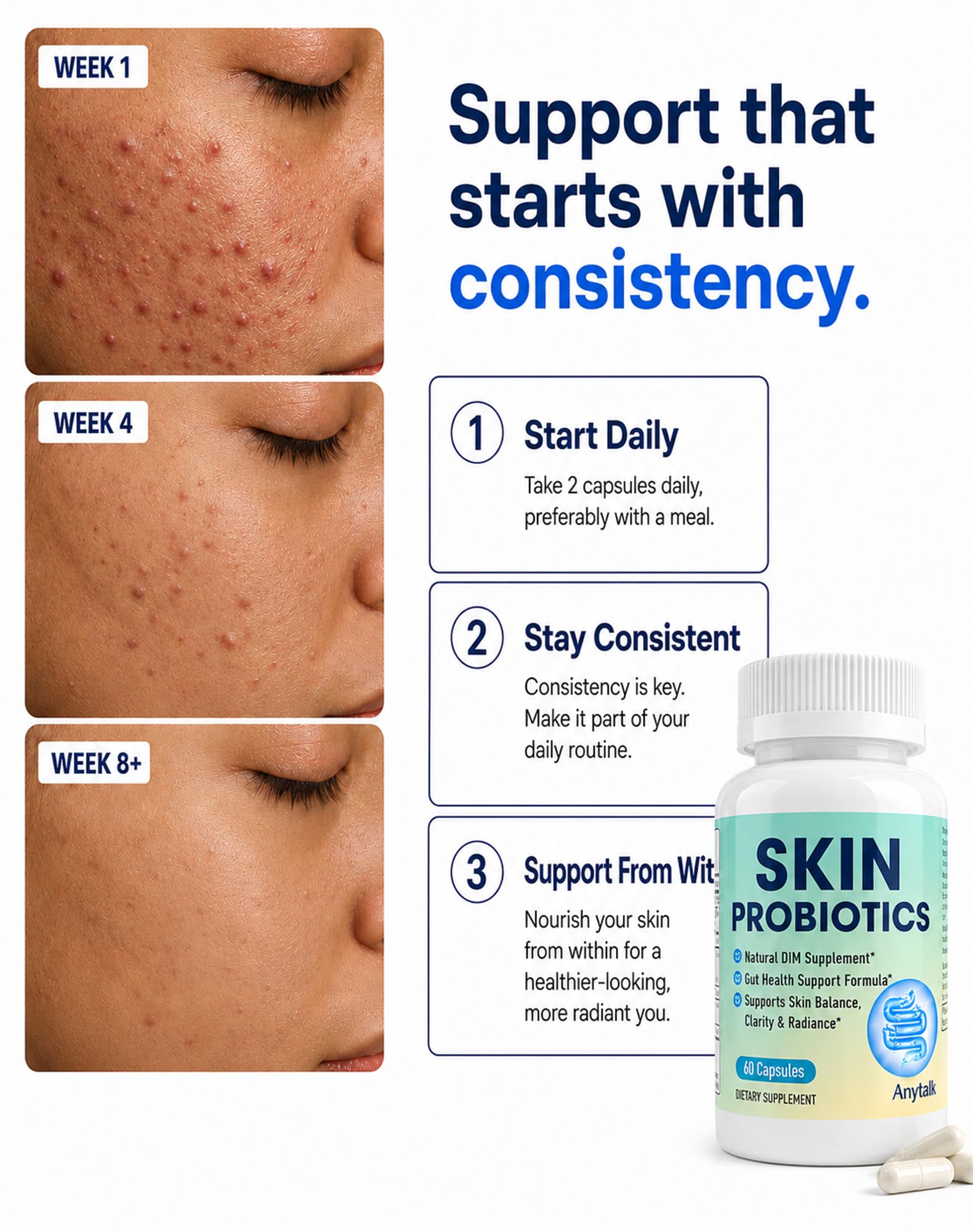 ANYTALK Skin Probiotic Supplement for Women & Men, DIM Capsules for Skin Clarity & Balance, Hormonal Acne Support Formula, Clear Skin Supplement with Vitamins & Enzymes, 60 Capsules — Amazon image 6