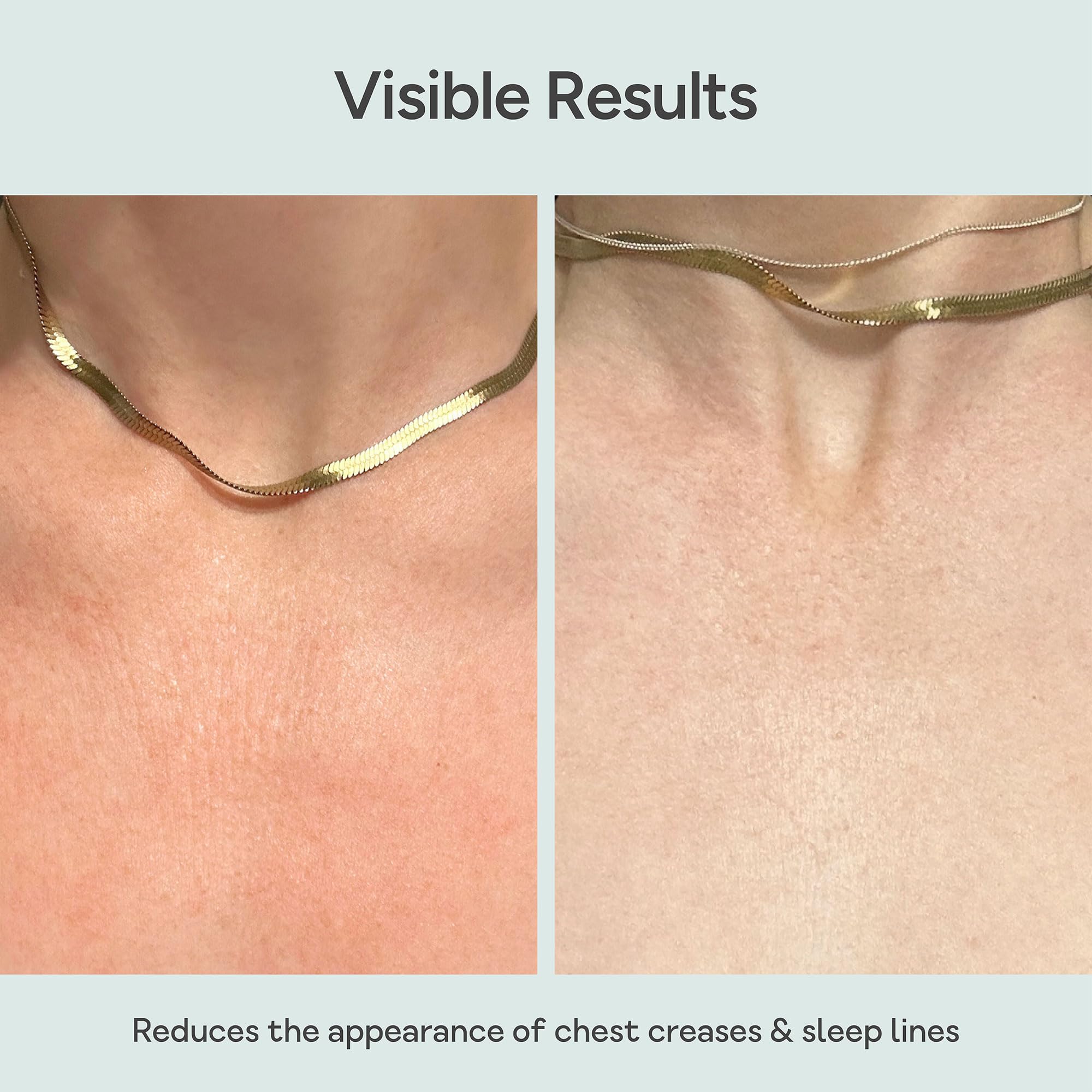 Patch antirughe riutilizzabile in silicone per il petto, 100% silicone di grado medico, ammorbidisce visibilmente le linee del sonno, décolleté e rughe di décolleté | 1 confezione