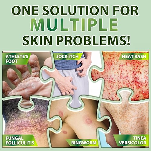 Miniatura 3 de Juego de champú para foliculitis y psoriasis del cuero cabelludo y crema de árbol de té para dermatitis seborreica, caspa, tiña e irritación