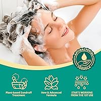 Vista 2 de Roycederm Champú anticaspa, Tratamiento de la caspa para cabello graso, Tratamiento seco del cuero cabelludo escamoso, Champú de cuero cabelludo